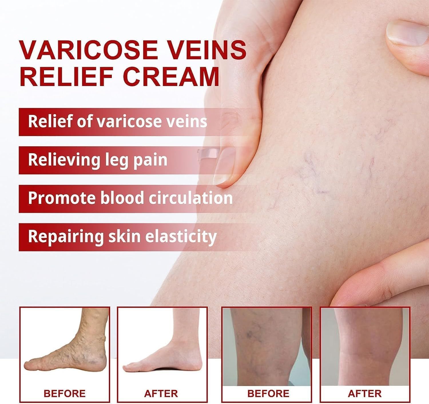 3 Pcs Medilisk Cream Varicose Veins,Medilisk Varicose Veins Relief Cream,Varicose Veins Treatment for Legs,Remove Varicose Veins, Improves Blood Circulation image number 6