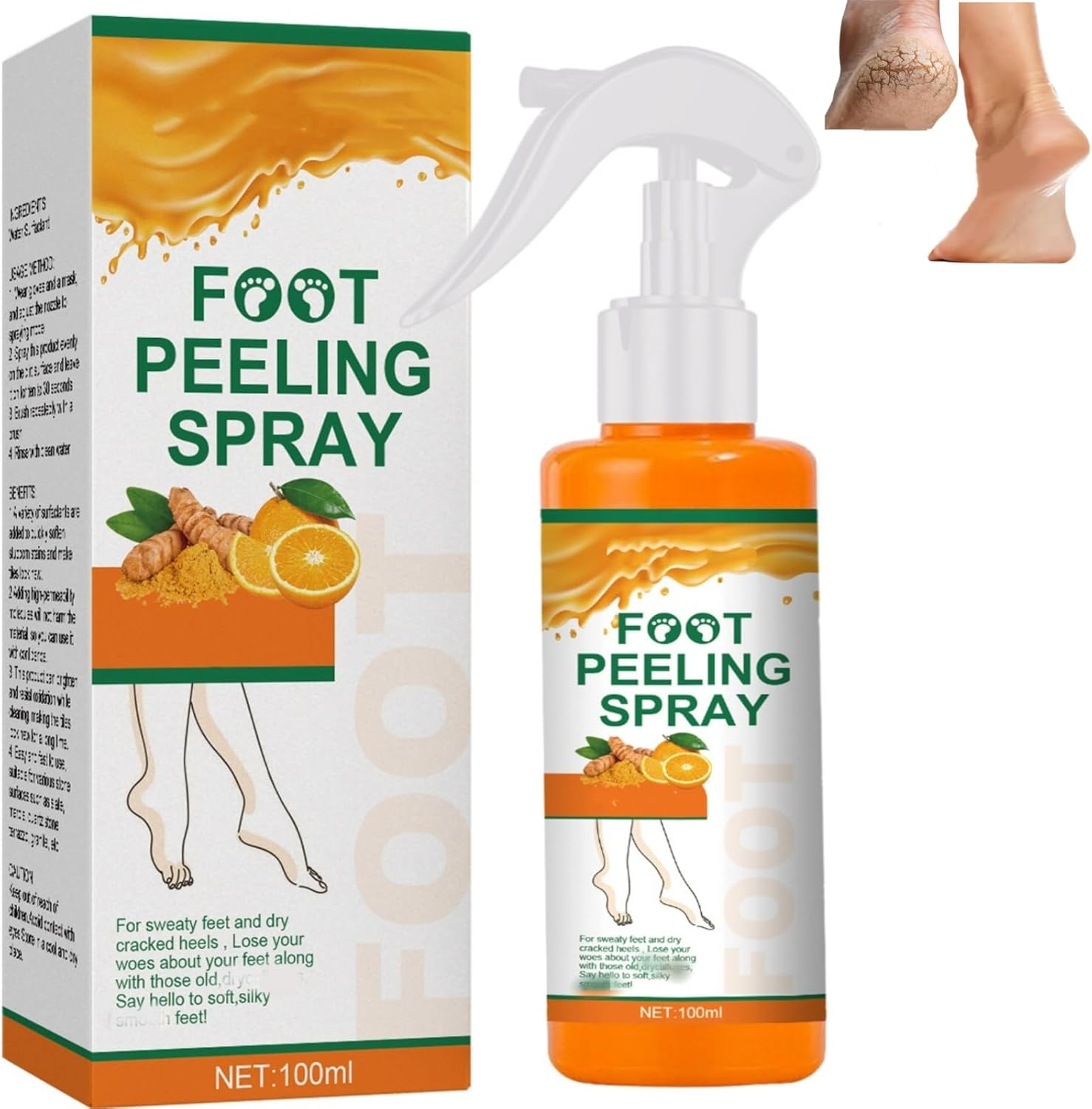 Foot Peeling Spray, Removal Dead Skin, Moisturized and Brighten Skin,Exfoliating Peeling Calluses on Feet, Smoothing Dry & Cracked Feet, Multi - Use for Hands & Joints,Knee,Ankle,Elbow (1PCS)