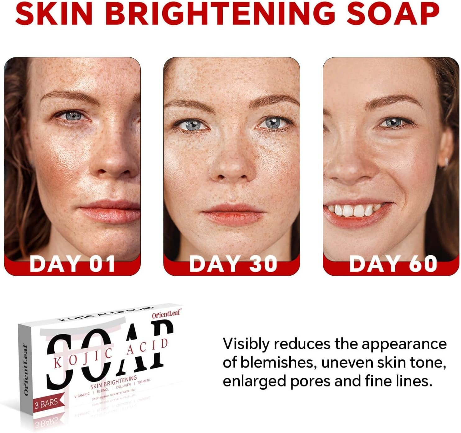 ORIENTLEAF Kojic Acid Soap, Turmeric Soap Bar, Fresh Citurs Scent, Gentle for Face and Body with Vitamin C, Shea Butter, Retinol, Olive Oil, Collagen (3 PACK) image number 5