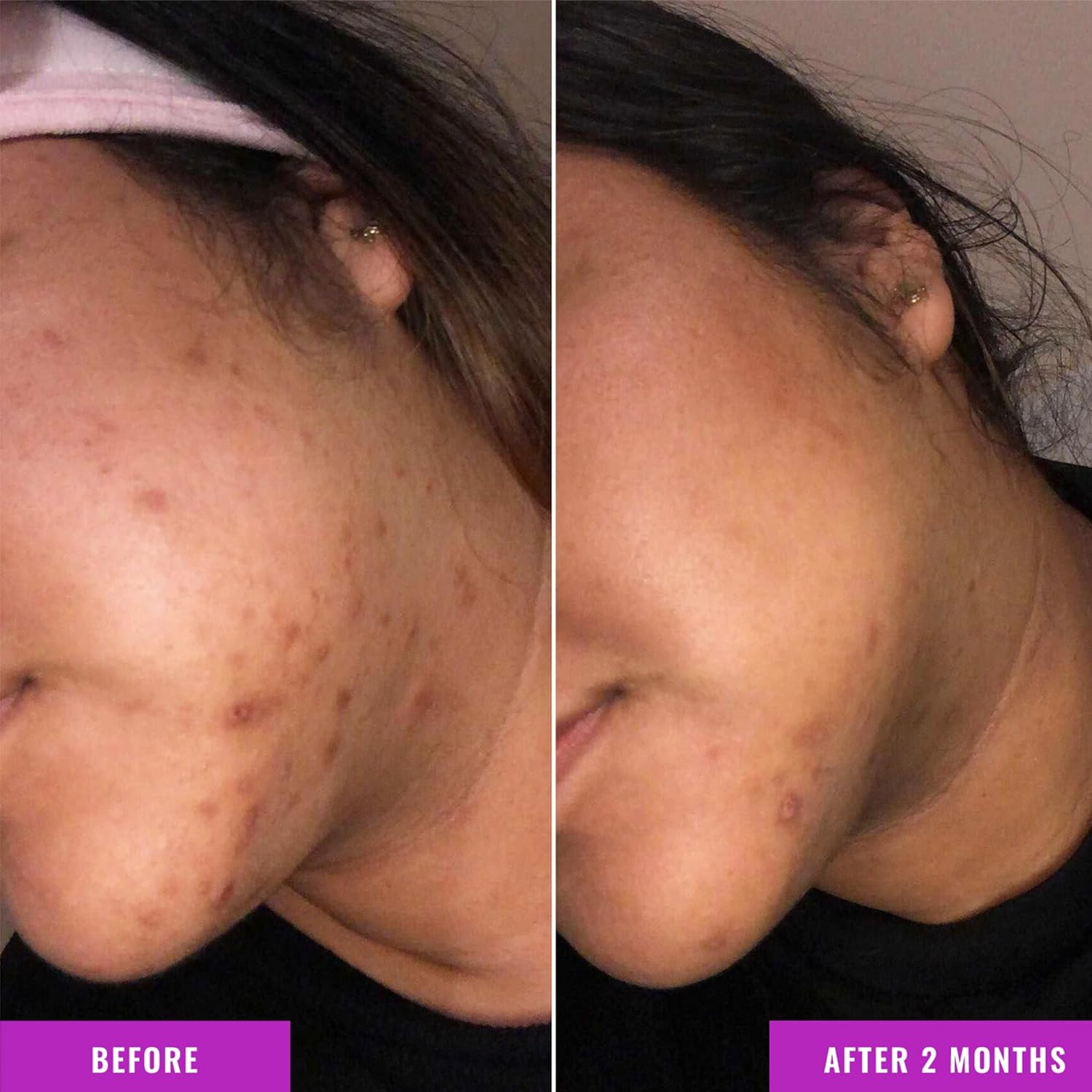 Good Molecules Discoloration Correcting Serum - Tranexamic Acid Ester Salt and Niacinamide for Dark Spots, Sun Damage, and Age Spots - Skincare Face image number 2