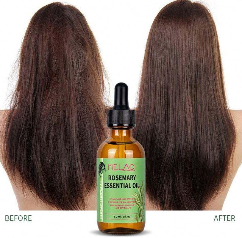 Rosemary & Mint Hair Oil, Split Ends & Dry Scalp Treatment - Made with Biotin & Essential Oils for Strengthening, Soothing, Moisturizing & Encouraging Longer, Healthier Hair image number 1