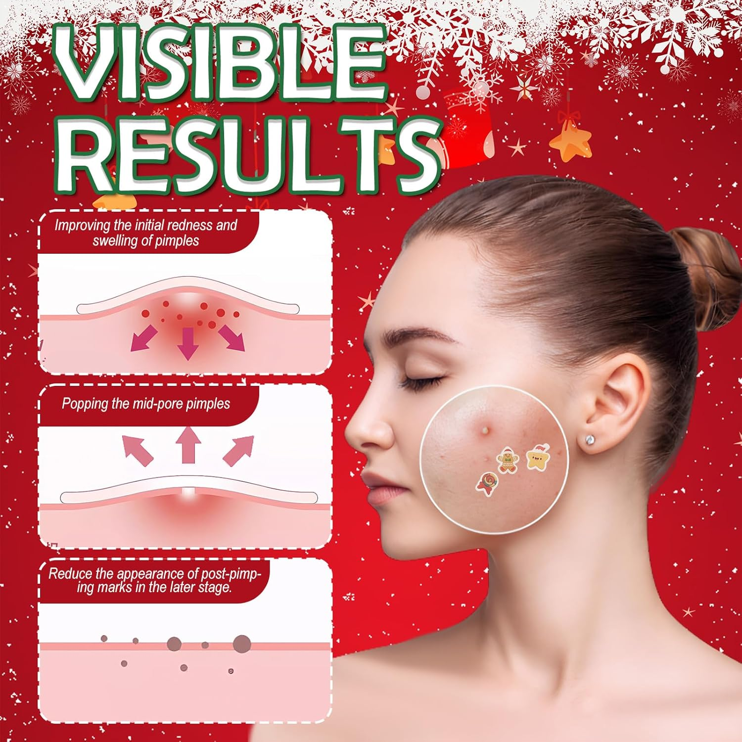 Pack of 12 Pimple Patches, Christmas Pimple Patches, anti Pimple Patches, Acne Patches, Day and Night Acne Patches, Waterproof, Breathable, Various Shapes image number 3