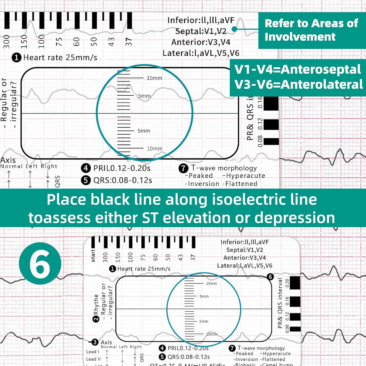 2 Pack Ecg-7-Step-Ruler - ECG/EKG Interpretation Tool, Portable Pocket Ruler, ECG Reference Guide, EKG Ruler Horizontal Badge Card Tool for Accurate Heart Rate and Interval Assessment image number 1