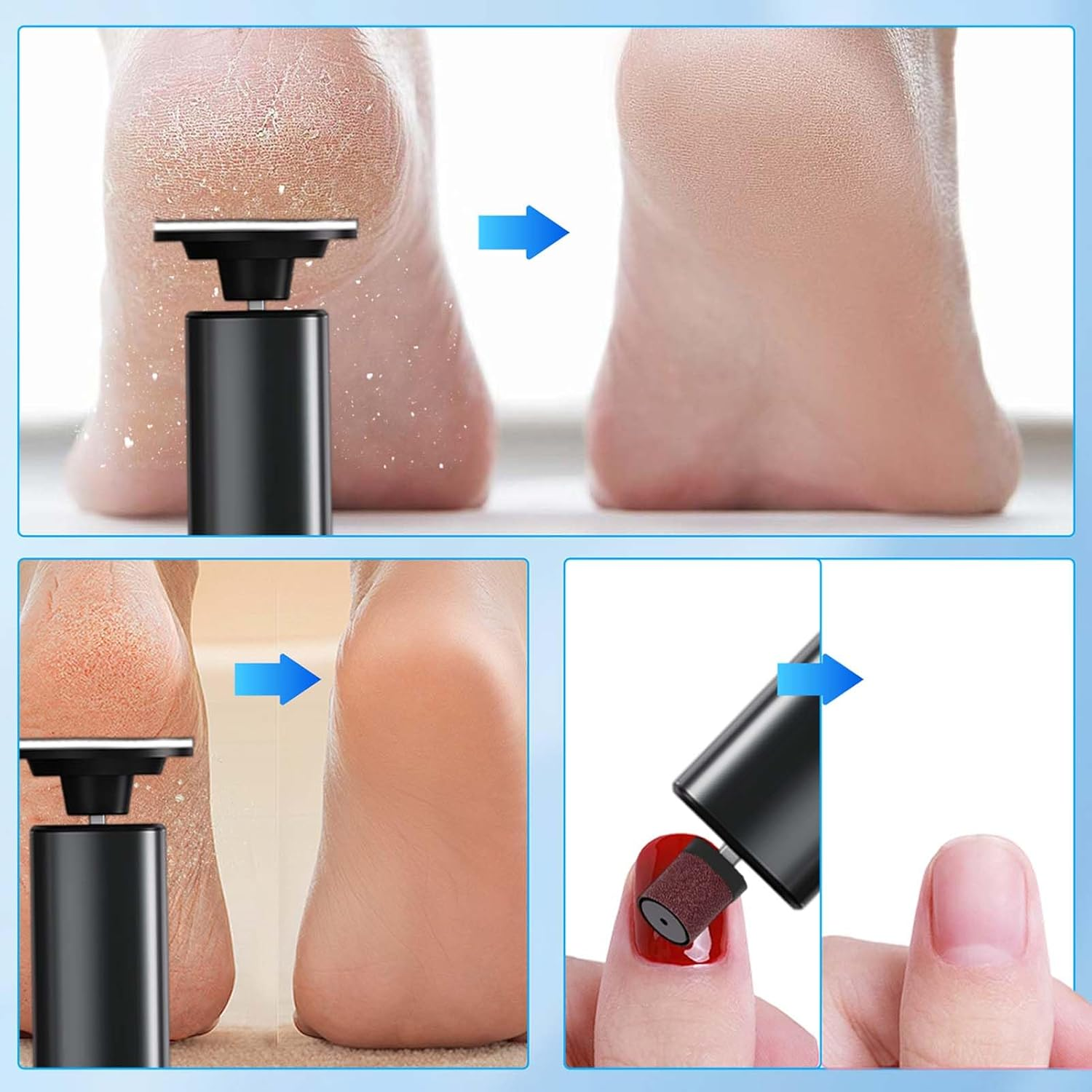 Electric Callus Remover, Rechargeable 9 Adjustable Speed Callus Remover with 30 Replacement Pads, Foot Care Device Pedicure for Dead/Hard/Cracked Skin, 2 in 1 for Foot and Hand Care image number 6