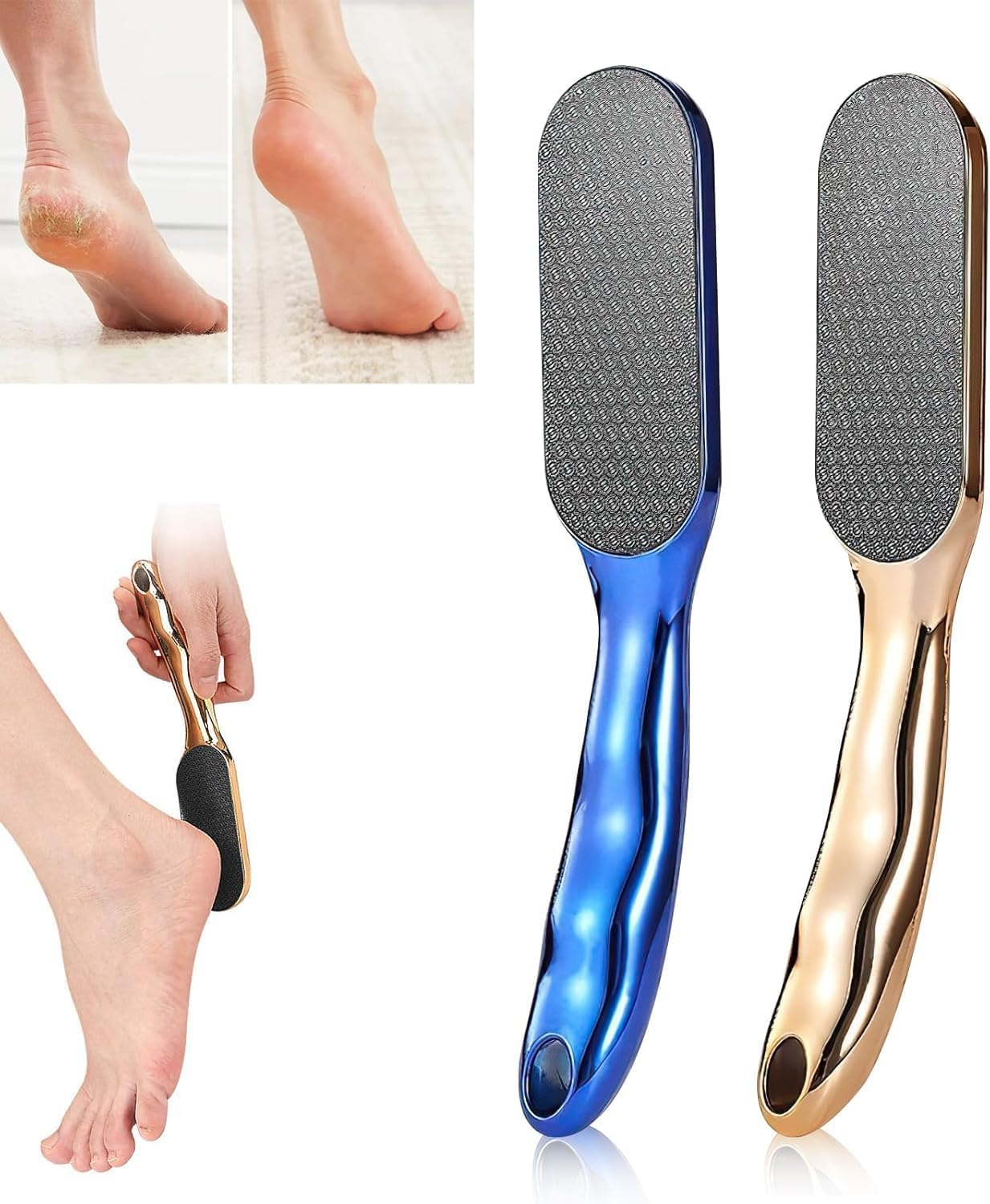 Veins Grain Foot File, 1Pc Veinsgrain Foot File, Dead Skin Remover Heel Scraper, Veins Grain Feet Callus Remover and Scrubber Heel Scraper for Wet and Dry Feet, Gold