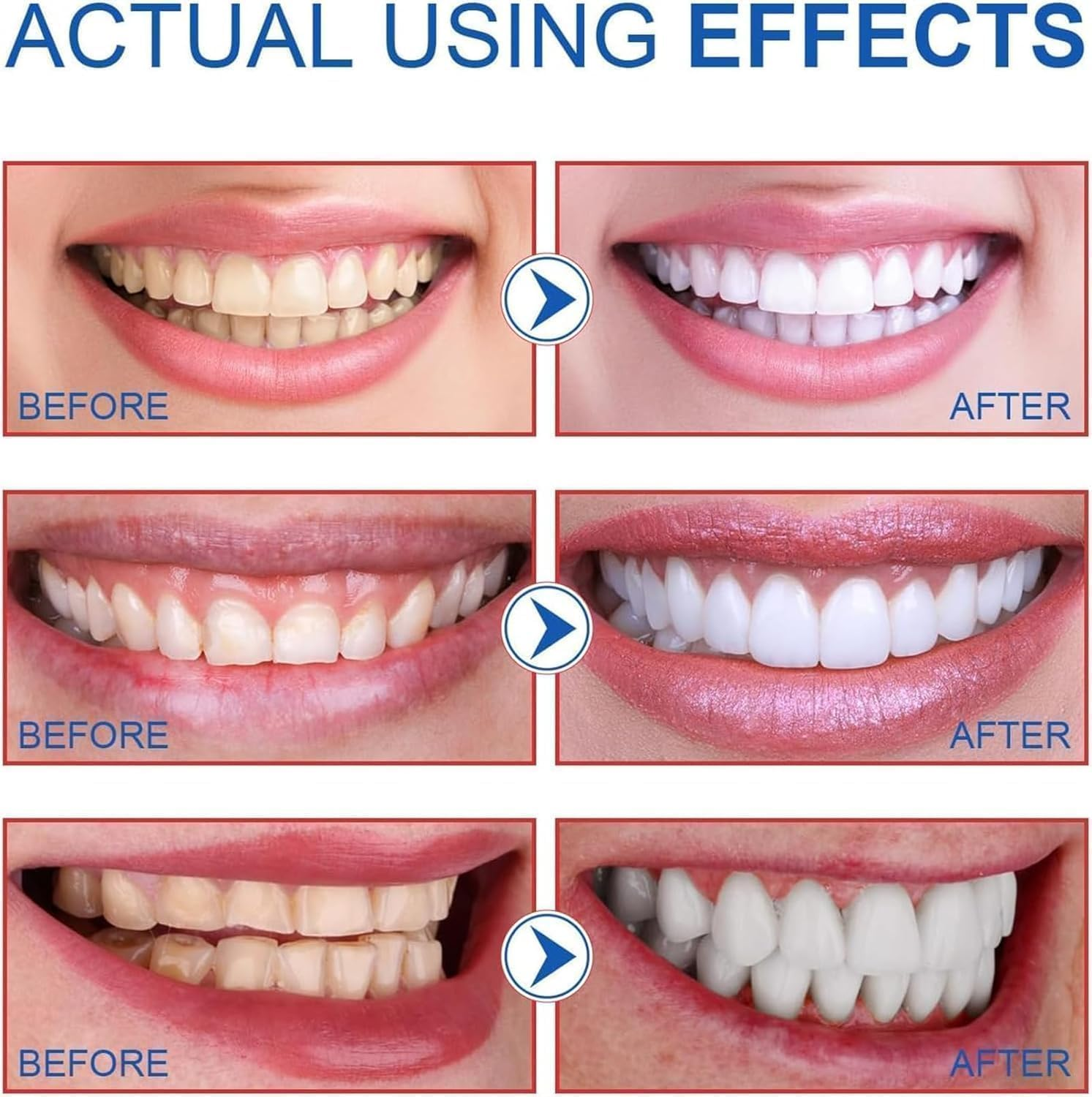 2Pcs Ms Drwikey Probiotics Bright White Toothpaste,Sp-6 Ultra Whitening Toothpaste,Probiotic Brightening Toothpaste,Deep Cleaning Care Toothpaste,Fresh Breath image number 2