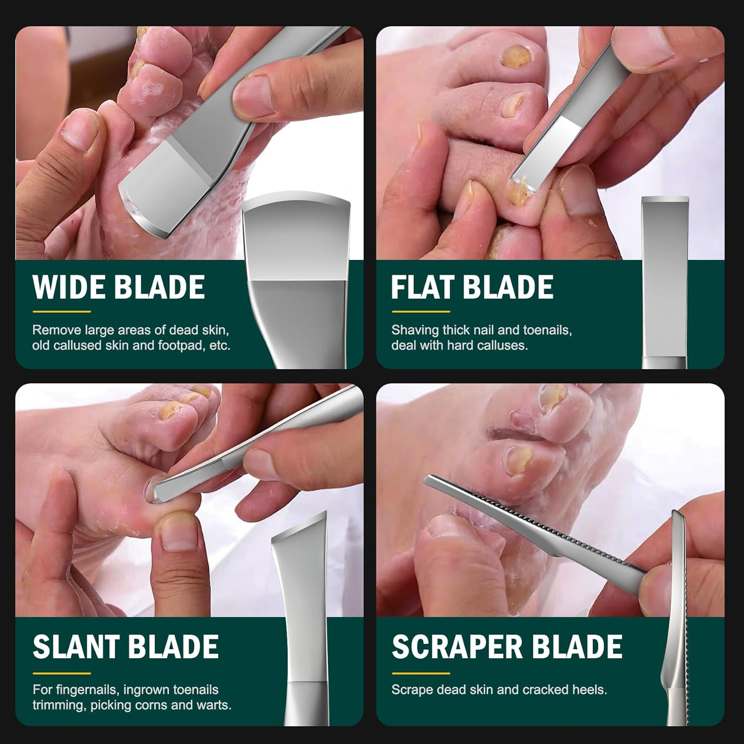 FVION Professional Pedicure Knife Set, 4PCS Ingrown Toenail Removal Blades Kit, Stainless Steel Callus Shaver Foot Blades - Silver image number 5