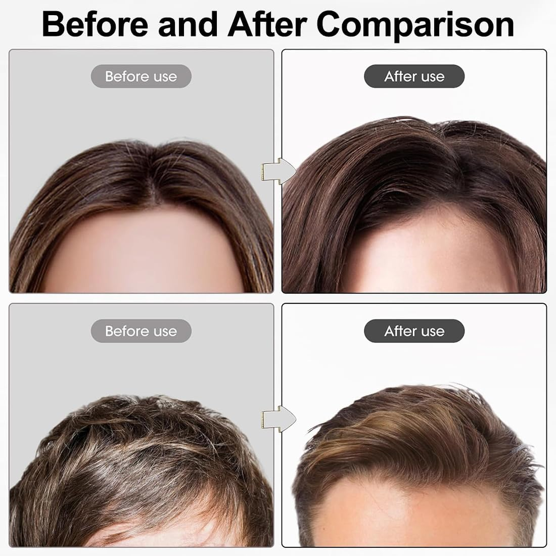 JYNVO 2Pcs Volume Clip, Volume Clip for Hairline, Hair Roots Lifting Clips, Unisex, Hairstyle Styling with Hair Lacquer, Fluffy Crown & Bangs image number 1