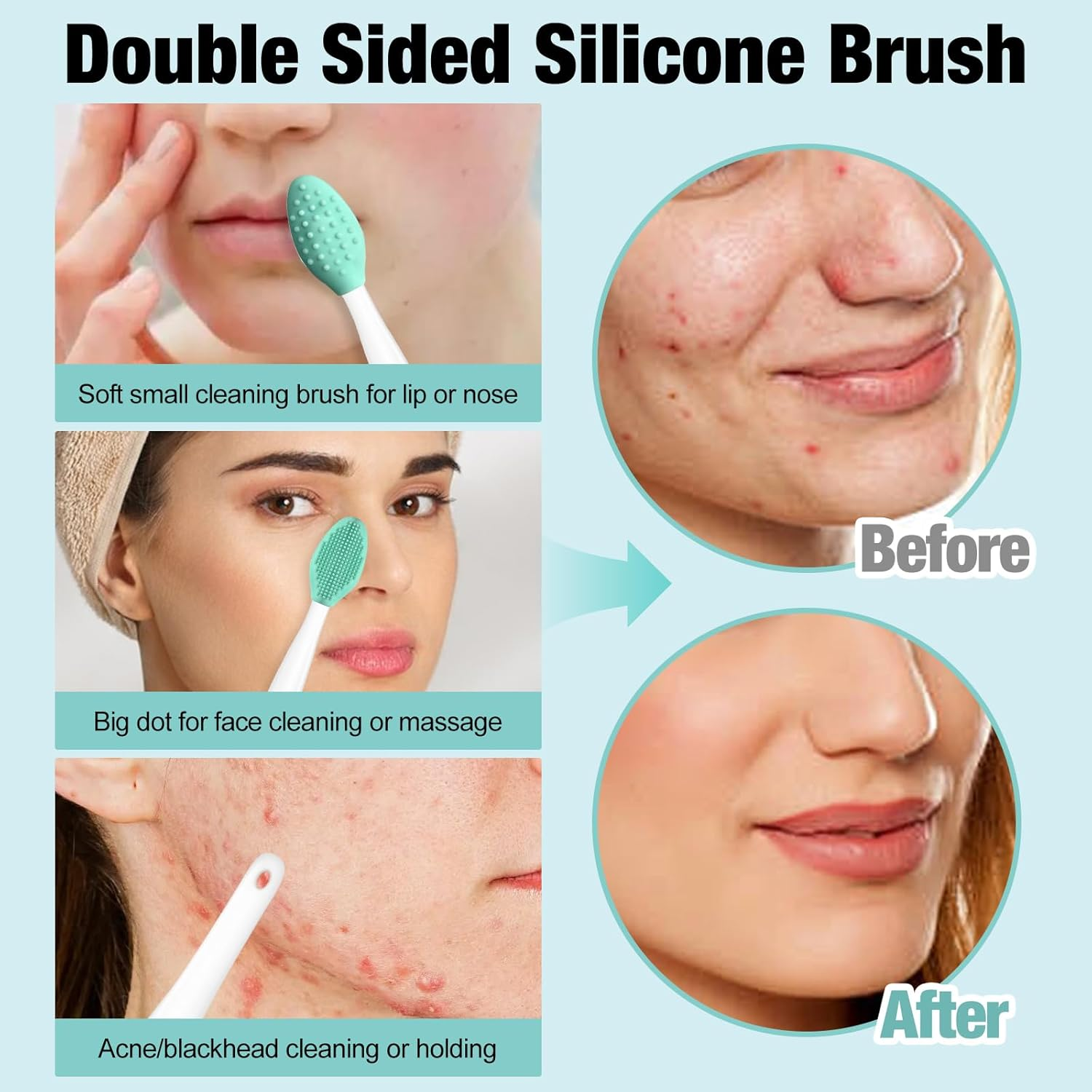 MUIIGOOD 3Pcs Blackhead Remover Pimple Popper Tool Kit Pimple Extractor Acne Treatment Surgical Grade Blackhead Comedone Removal Popper Tool Cleaning Brush for Face Nose Lips image number 3