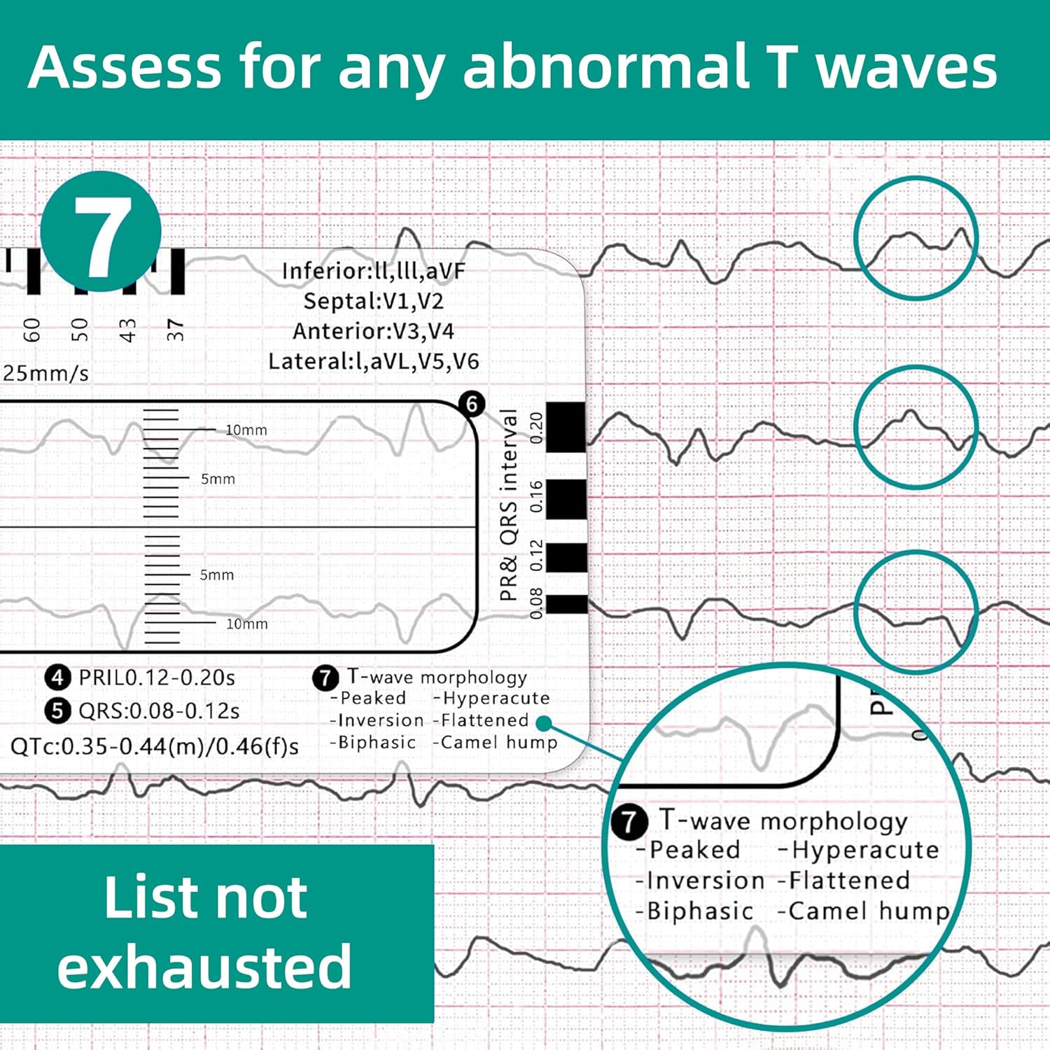 2 Pack Ecg-7-Step-Ruler - ECG/EKG Interpretation Tool, Portable Pocket Ruler, ECG Reference Guide, EKG Ruler Horizontal Badge Card Tool for Accurate Heart Rate and Interval Assessment image number 5