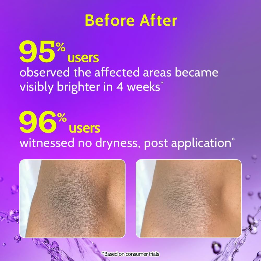 Chemist at Play Brightening & Whitening Roll on for Neck, Knee & Elbow with 6% Vitamin C+ Hyaluronic Acid + Ahas + Niacinamide + Ceramides Exfoliates, Brightens Skin & Hydrates Dry Skin 40Ml image number 1