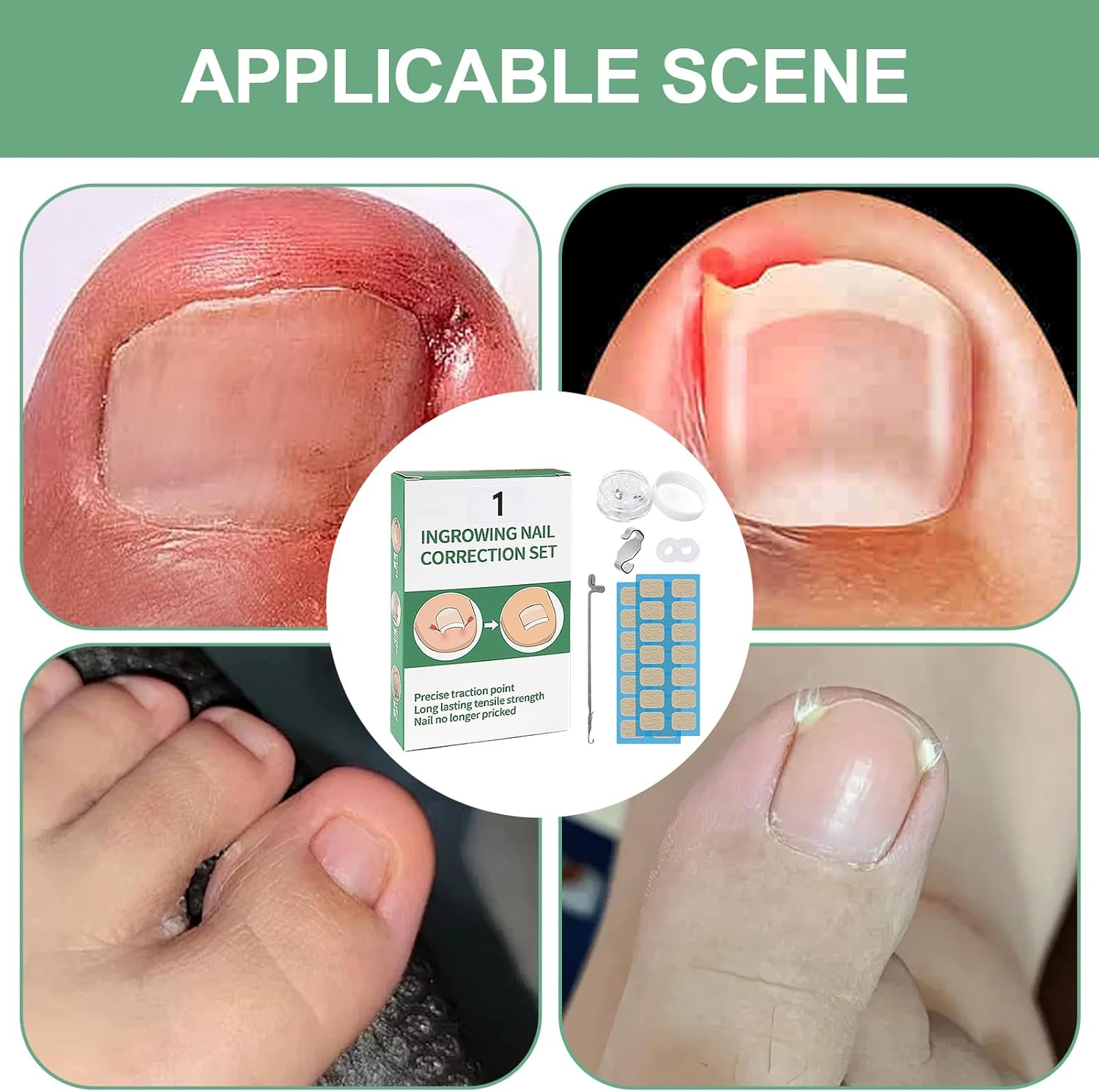 Nail Corrector Patch | Renewal Ingrown Toe Nail Stickers - Breathable Toenail Straightening Tool for Adults Family Friends Foot Care Accessories image number 1