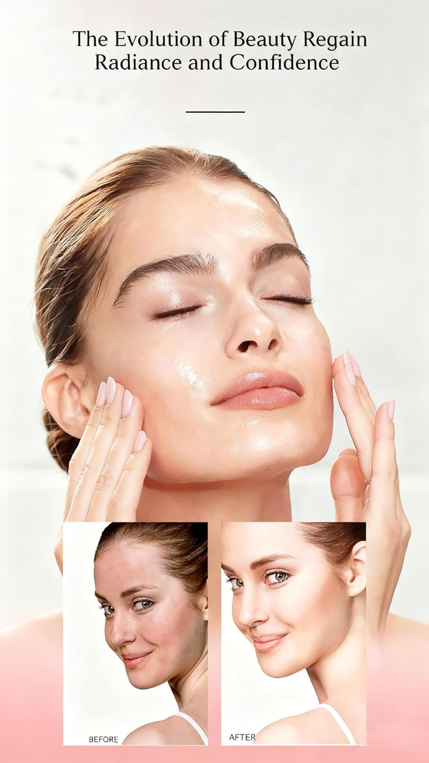 Niacinamide 10% + TXA 4% Serum, Dark Spots Corrector, Even Skin Tone, 30Ml image number 3