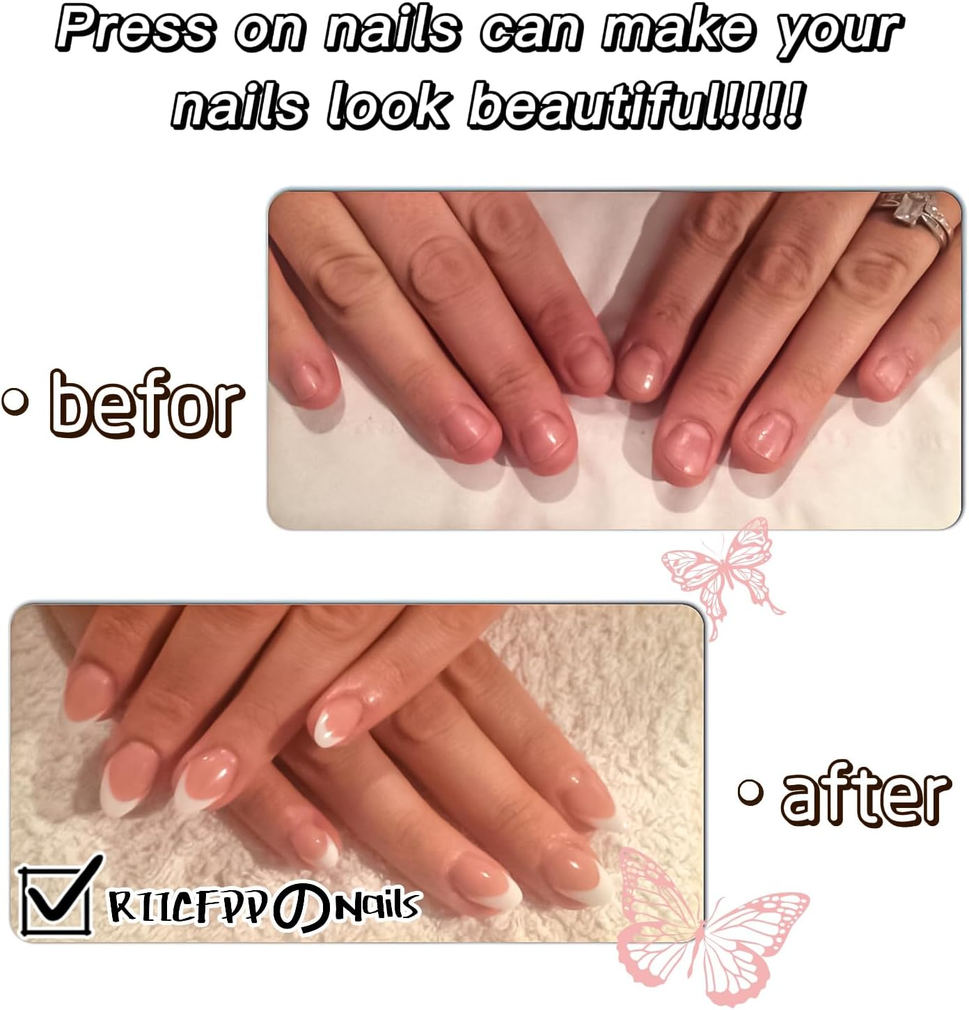 RIICFDD 24 Pieces Almond Style Short False Nails with French Tip, 5D Flower, Drawings, Yellow Tips, Bright Pink Acrylic for Women image number 2