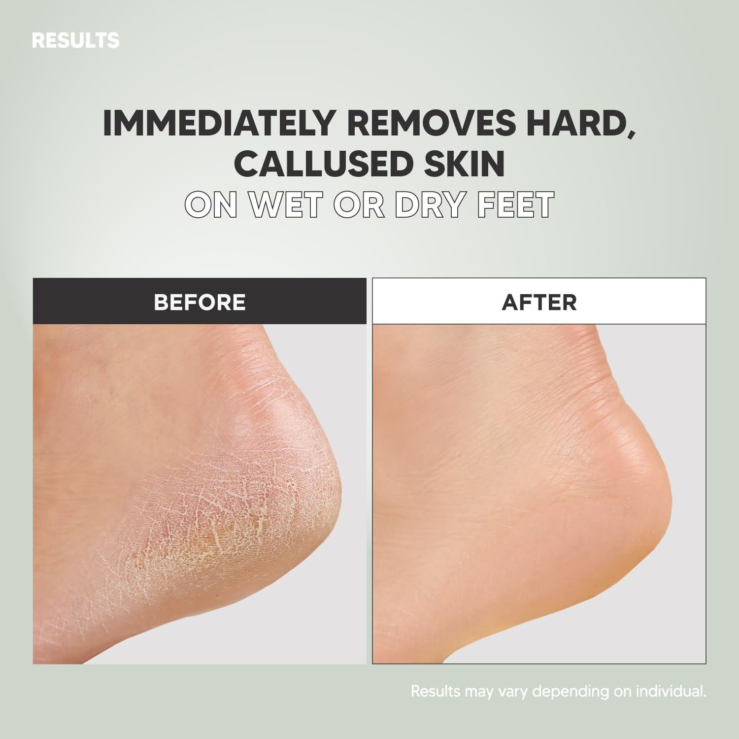 F3 Systems S-Line Emery Foot File, Colossal Double-Sided Pedicure Tool, Effective for Cracked Heel, Ergonomic Design for Easy Grip (White)