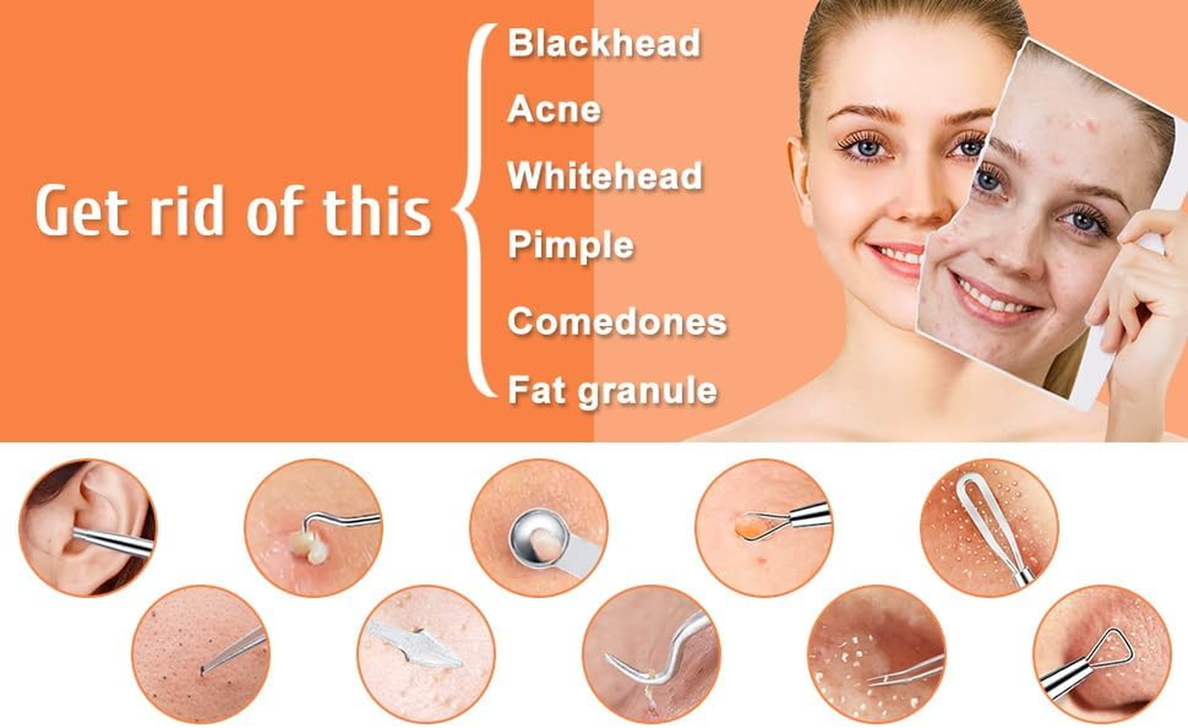 Blackhead Remover Comedone Extractor,15 Pcs Professional Stainless Steel Blackhead Remover Comedone Extractor Tools with Metal Case,Pimple Popper Tool Kit for Blackheads, Blemish, Comdone, Acne