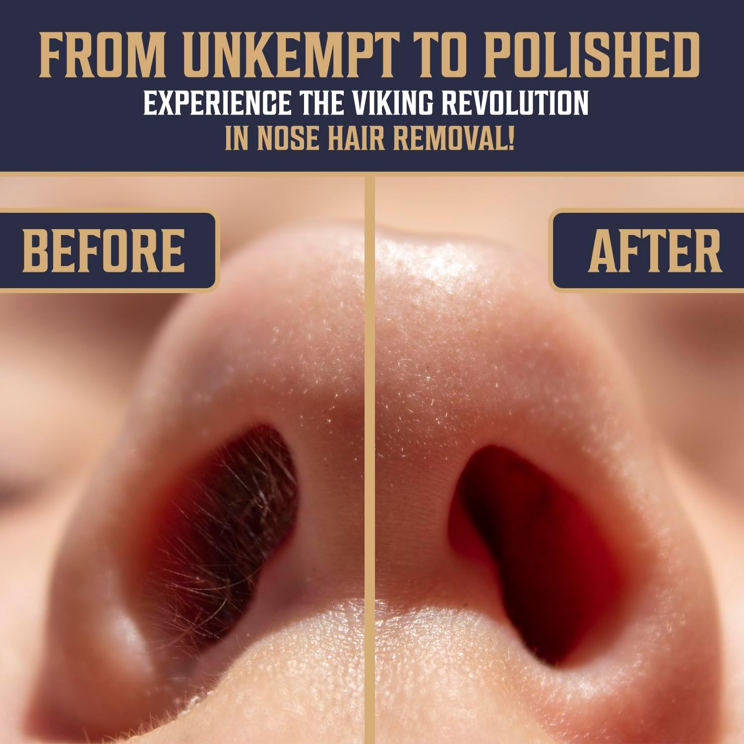 Viking Revolution Nose Hair Waxing Kit for Men - Quick Kit Men with 24 Wax Sticks - Nose Hair Wax Kit Includes Mustache Sticker Guard and Post-Wax Calming Wipes with Aloe Vera (3.5 Oz) image number 1