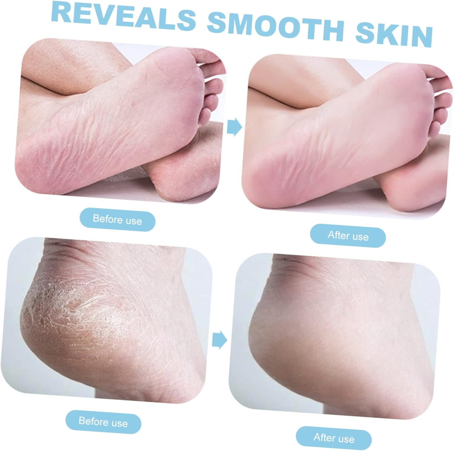 Manual Foot Care File Portable Exfoliating Callus Remover for Dead Skin High Grade Material Foot File for Smooth Skin for Home Use Space Saving Design image number 3