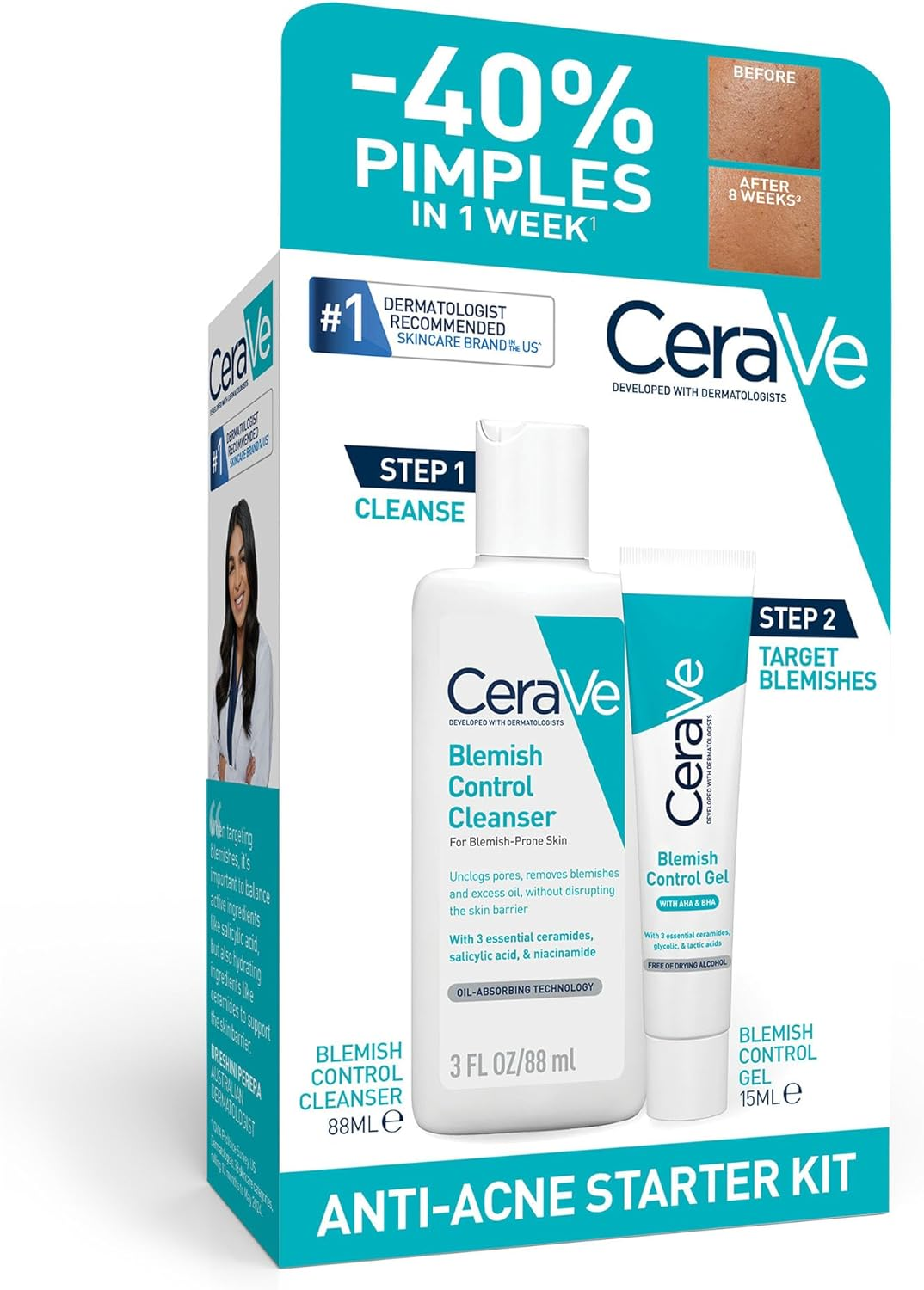Cerave Anti-Acne Starter Kit Contains Blemish Control Cleanser 88Ml + Blemish Control Gel 15Ml, for Mild Acne Prone Skin Treats Pimples, Blackheads, Marks, Travel Size Cleanser & Serum for International Flights, Trial Size