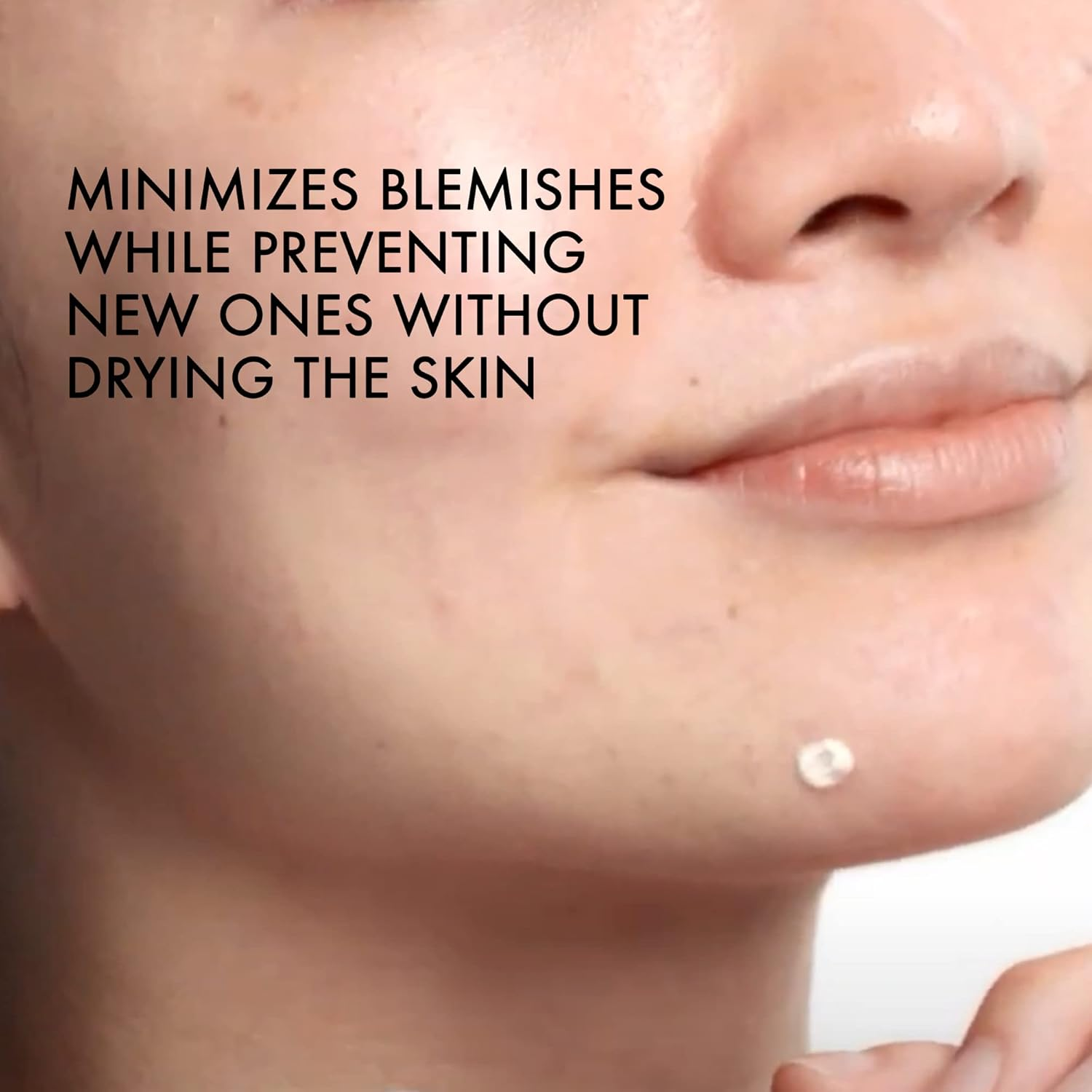 Vichy Normaderm Phytosolution S.O.S Sulphur Anti-Spot Paste 20Ml