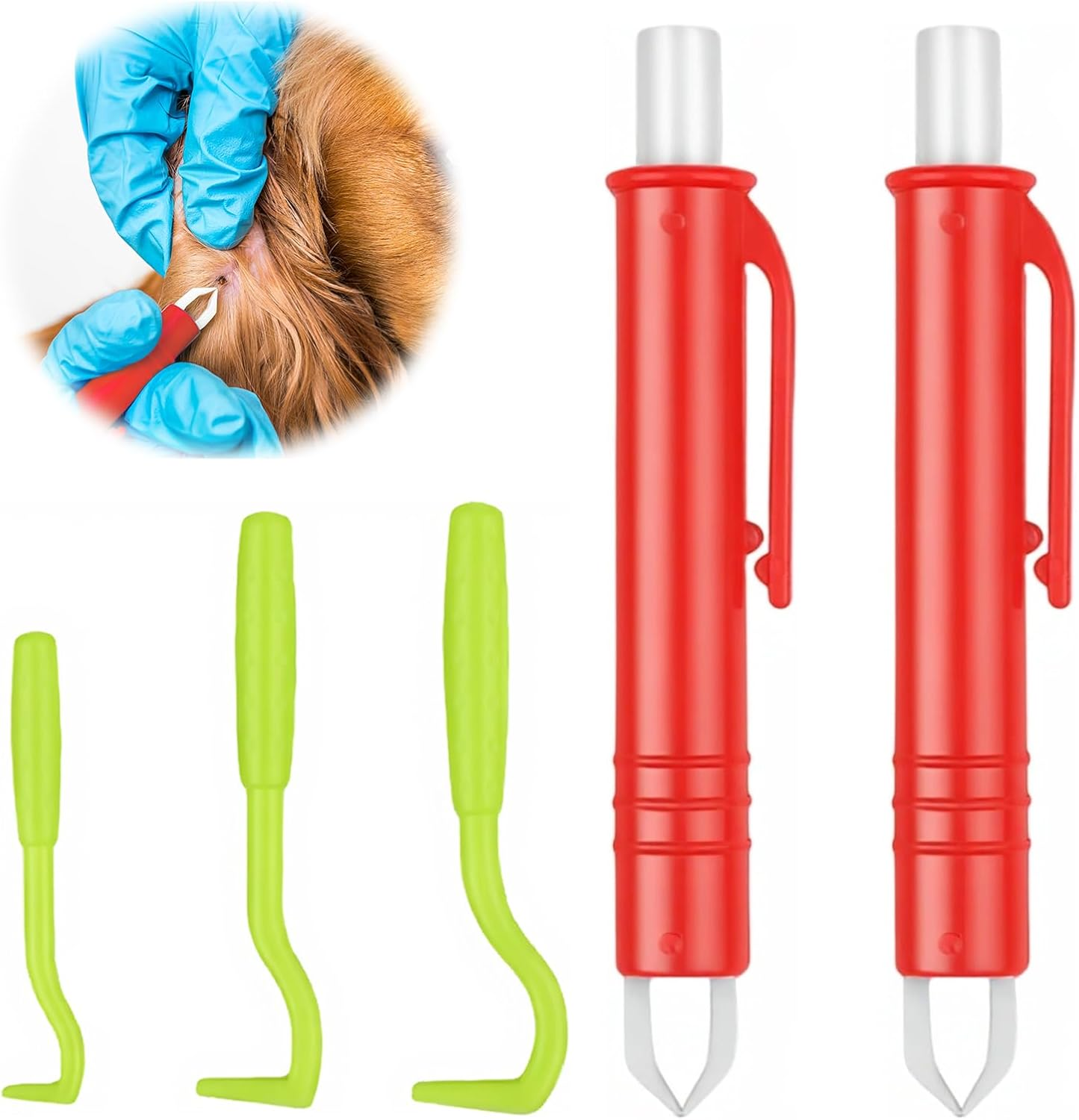 Wefaly Tick Tweezers for Dogs, Cats, Humans, Simple and Safe Tick Remover for Ticks of Any Size image number 2
