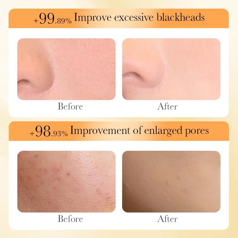 A Set of Rice Plasma Brightening and Repairing Freeze-Dried Powder to Nourish and Repair Deeply Cleansed Skin image number 6