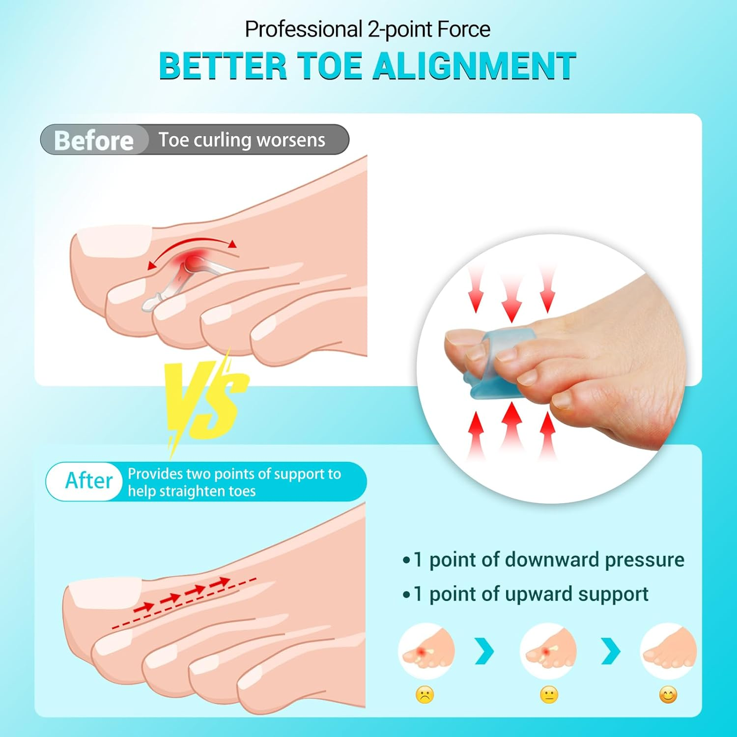 Hammer Toe Straightener Corrector for Women & Men - 6Pcs(Blue) - Hammer Toe Straightener, Gel Toe Splints - Realign Bent, Curled, Crooked, Claw, Hammer Toes - 3 Different Sizes (S/M/L)