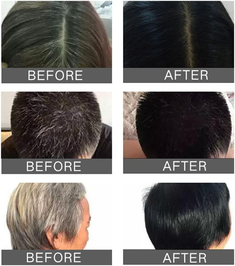 3Pc/Lot Natural Herbal Long Lasting Permanent Black Hair Dye Shampoo Fastly Covering Grey White Hair Shampoo Black Hair Dye Shampoo 3 in 1 Women,Plant-Based Hair Color image number 4