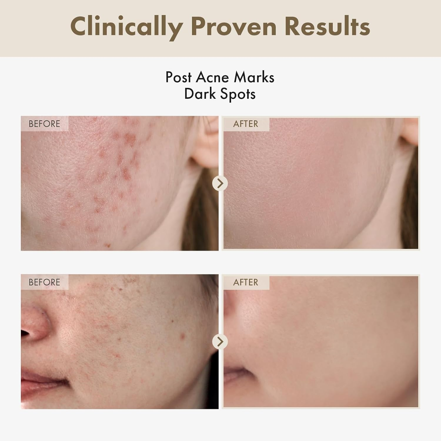 TOSOWOONG Alpha Arbutin 2% Rice Serum, Rice 746,074Ppm, Alpha-Arbutin 20,000Ppm, Glow, Glass Skin, Pigmentation, Acne Marks, Dark Spots, Even Skin Tone, Hydrating, Korean Skin Care, 33Ml / 1.11 Fl.Oz. image number 3