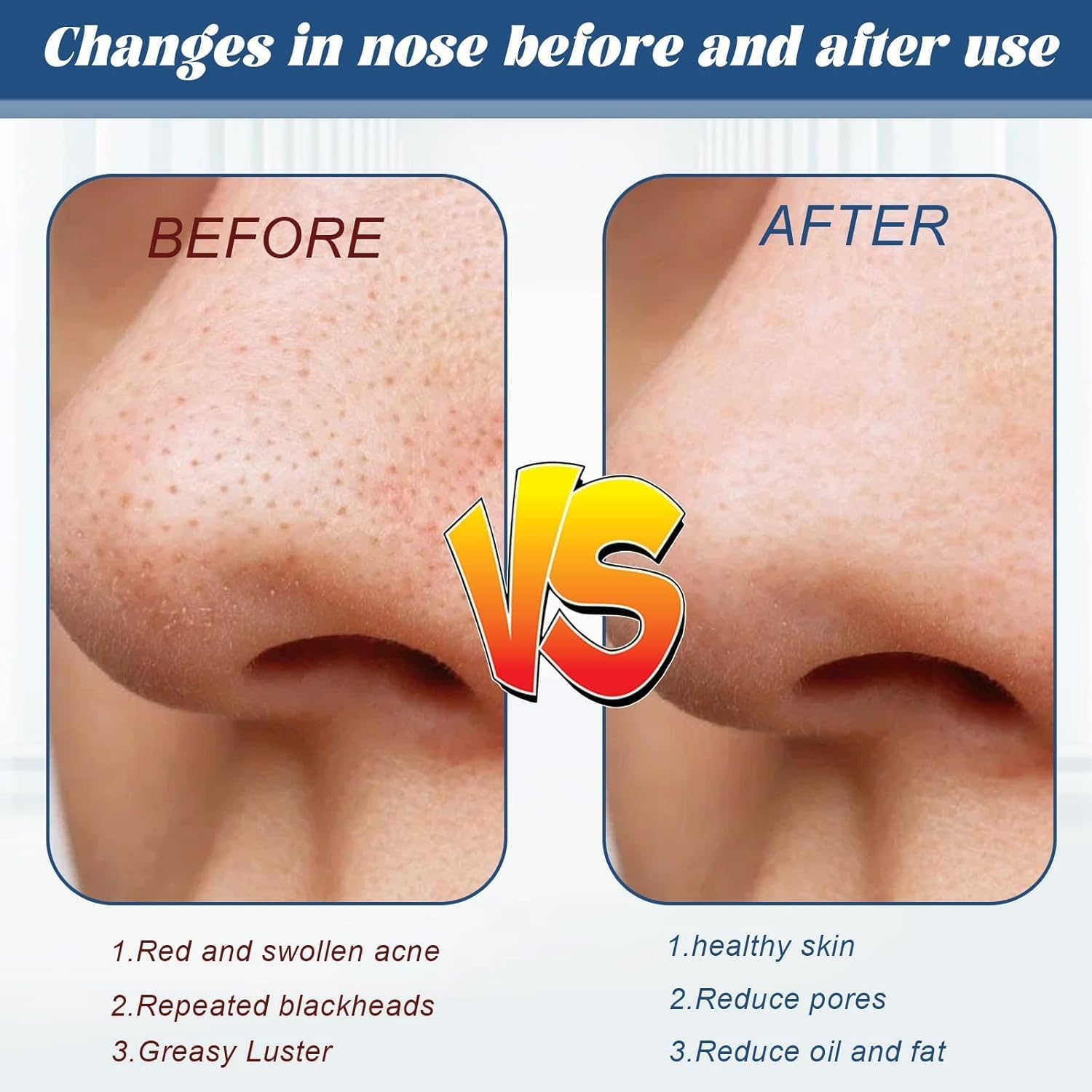 100 Pcs Blackhead Removal Strip, Nose Strip, Blackhead Pore Strip, Charcoal Deep Cleaning Nose Strip, Suitable for Men and Women image number 3