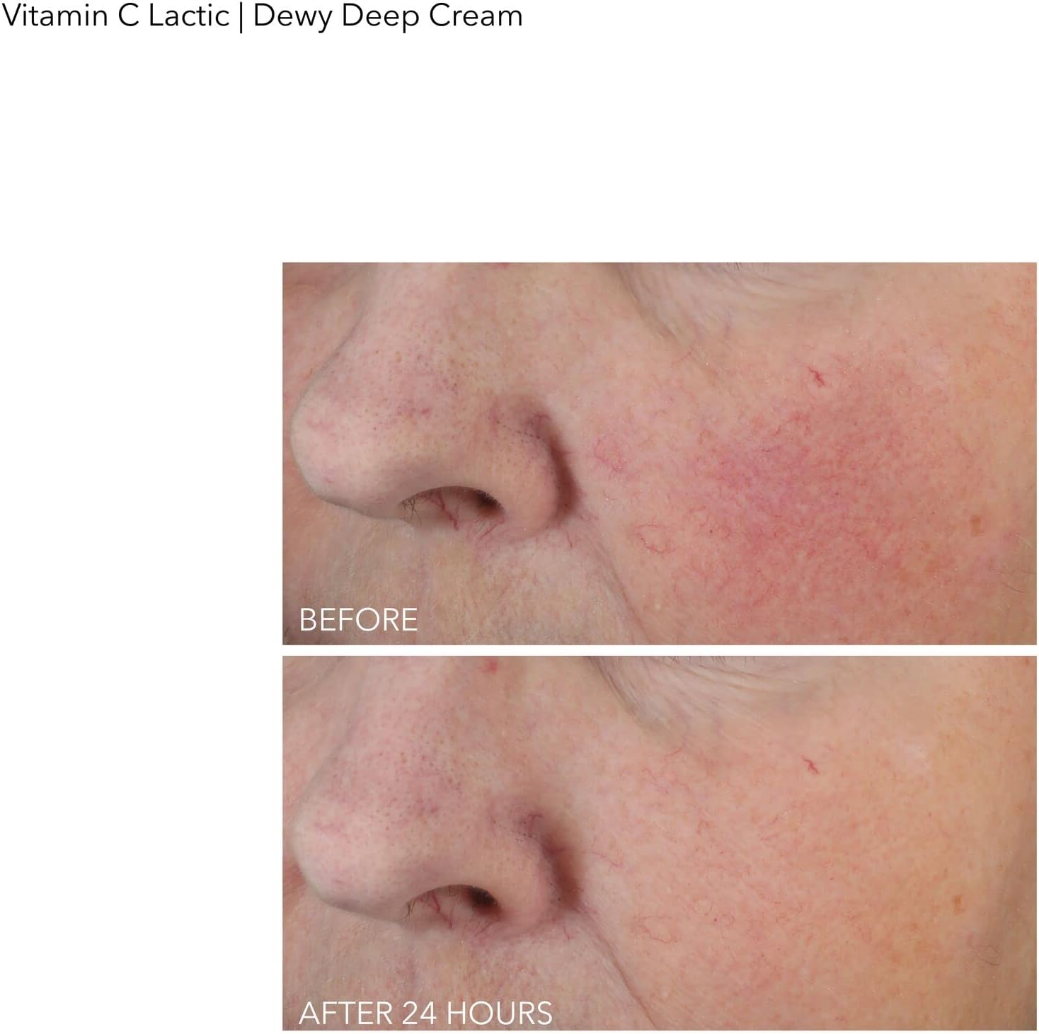 Dr Dennis Gross Vitamin C plus Lactic Firm and Bright Eye Treatment for Women 2 Oz Treatment