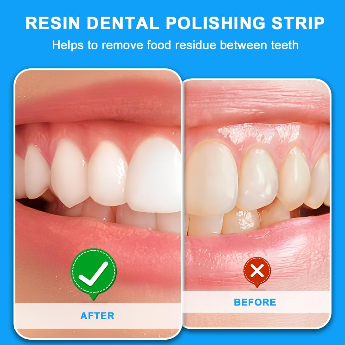 Tomedeks Dental Polishing Strips,1Pcs 30&Mu;m 6M/Roll Dental Abrasive Strip+ 3Cleaning Sponge,Resin Teeth Whitening Strips,Portable Teeth Polish,Tooth Polish Grinding Strip,Tooth Sandpaper(Blue-Medium) image number 5