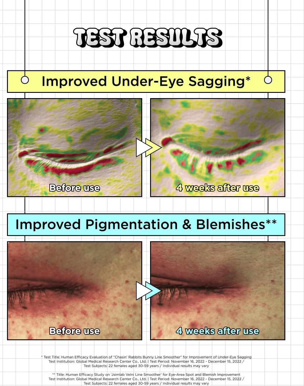 CHASIN' RABBITS Bunny Line Smoother Eye Cream Roller, 0.5 Fl Oz, Eye Cream with Surgical Steel Ball Rolling Stick, Eye Roller for Wrinkles, Dark Circles and under Eye Bags, Vegan, Korean Skin Care image number 1