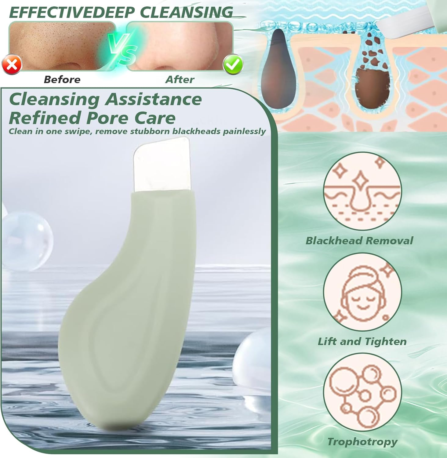 Blackhead Remover Tools Deep Clean Master Pore Face Scraper Facial Tools with Silicone Lid Face Pimple Scraper Can Be Used with Mud Cream & Cleansing Oil Sebum Remover Tool Suitable for Unisex (Green) - Skin image number 7