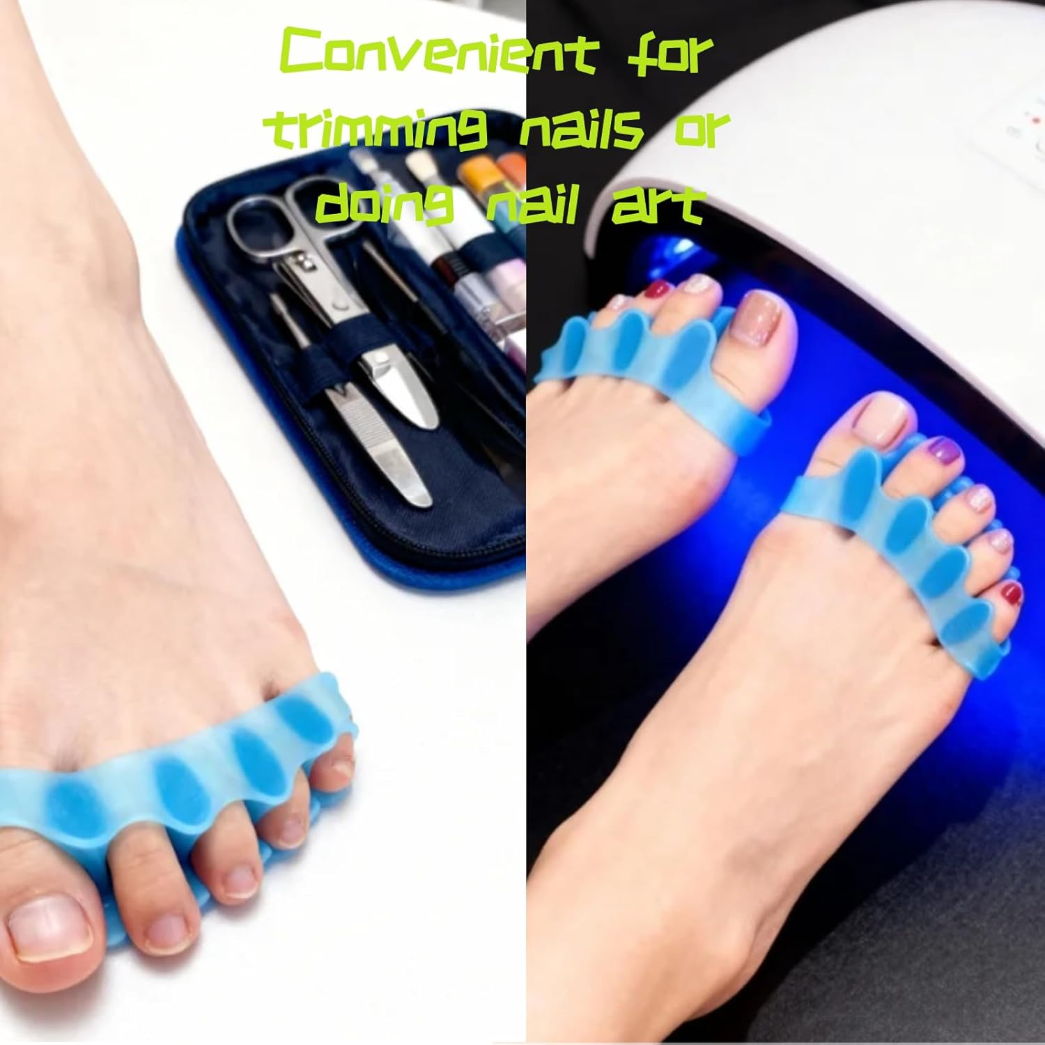 Kalione Professional SEBS Toe Separators, Blue, 8.5X3.5X1.4Cm, Reusable Stretching Spacers for Nail Care and Alignment, 4 Pack, Adult Size image number 1