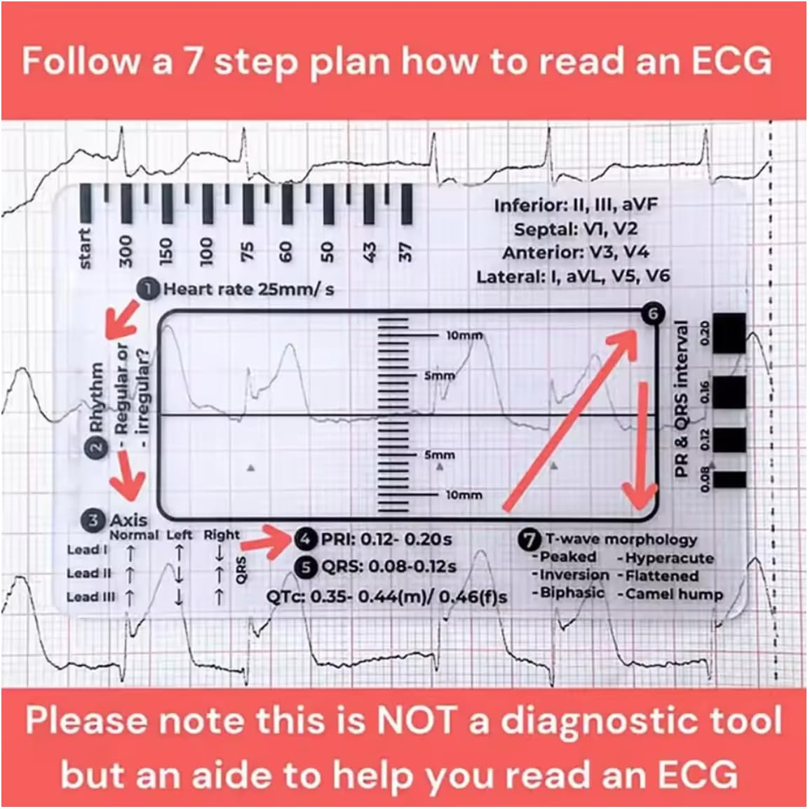 ECG 7 Step Ruler image number 4