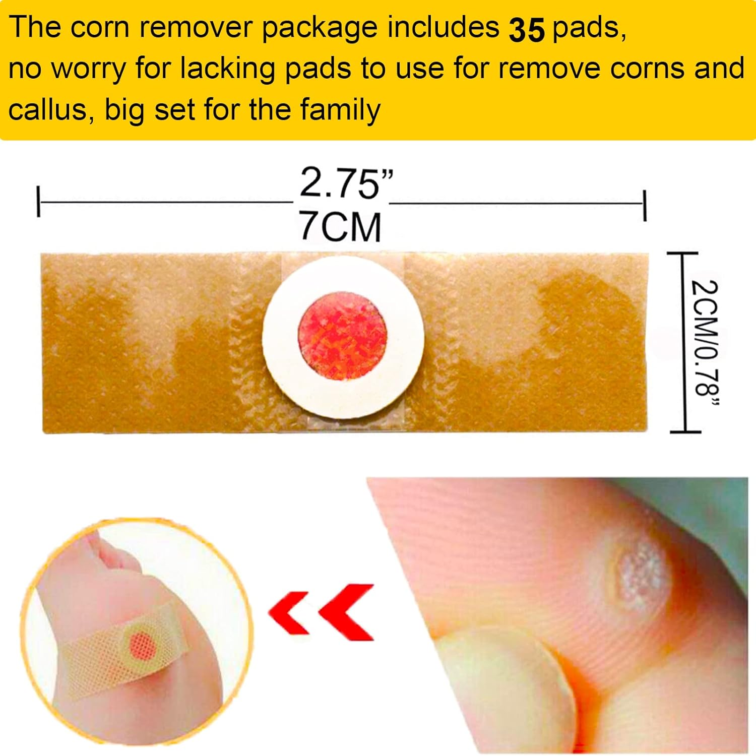 Reppkyh 24 Pieces Corn Removers for Feet, Corn Removers for Toe, Foot Corn-Toe Corn-Callus Removal, Corn Remover Feet