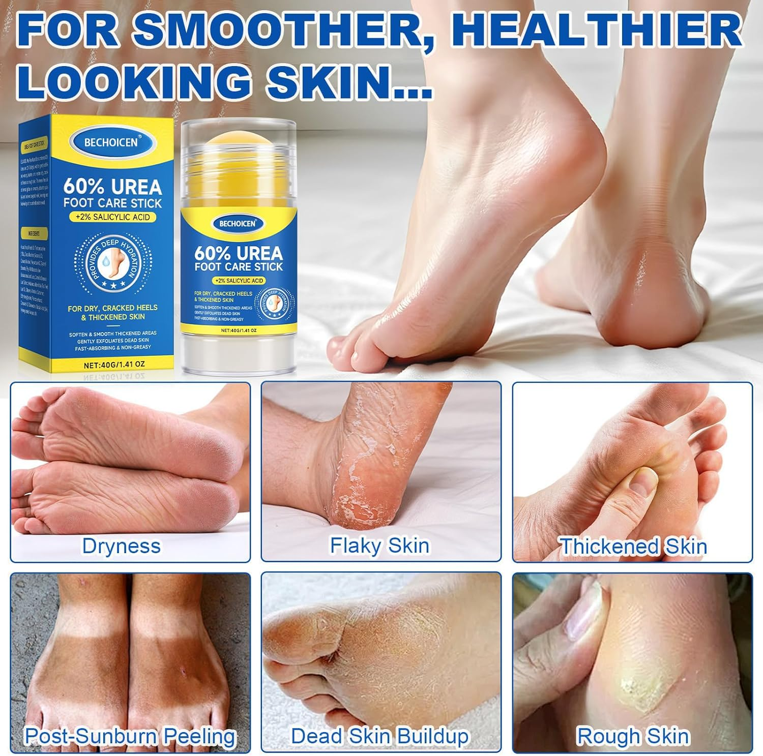 Urea Cream 60 Percent for Feet with 2% Salicylic Acid - Heel Balm,Foot Cream for Dry Cracked Feet,Cracked Heel Repair,Exfoliate Foot Skin,40G,1Pcs image number 3