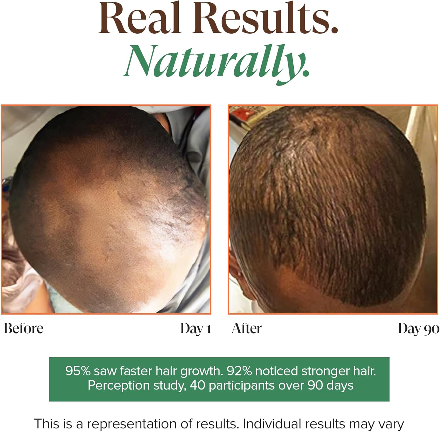 Haitian Black Castor Oil - 100% Pure & Unrefined (Lwil Maskriti/Palma Christi) (100Ml) image number 2