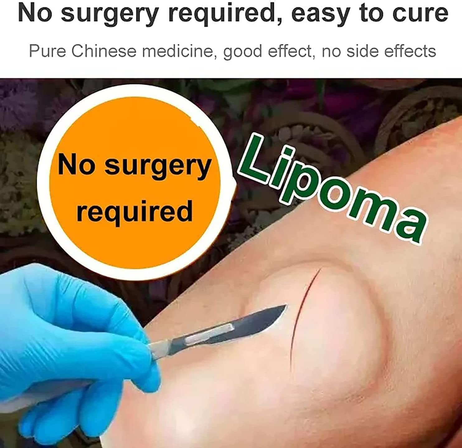 3Pcs Lipoma Removal Cream,Huangfutang Lipoma Removal Cream,Herbal Lipoma Removal Cream,Safe and Effective Get Rid of Your Fatty Lumps