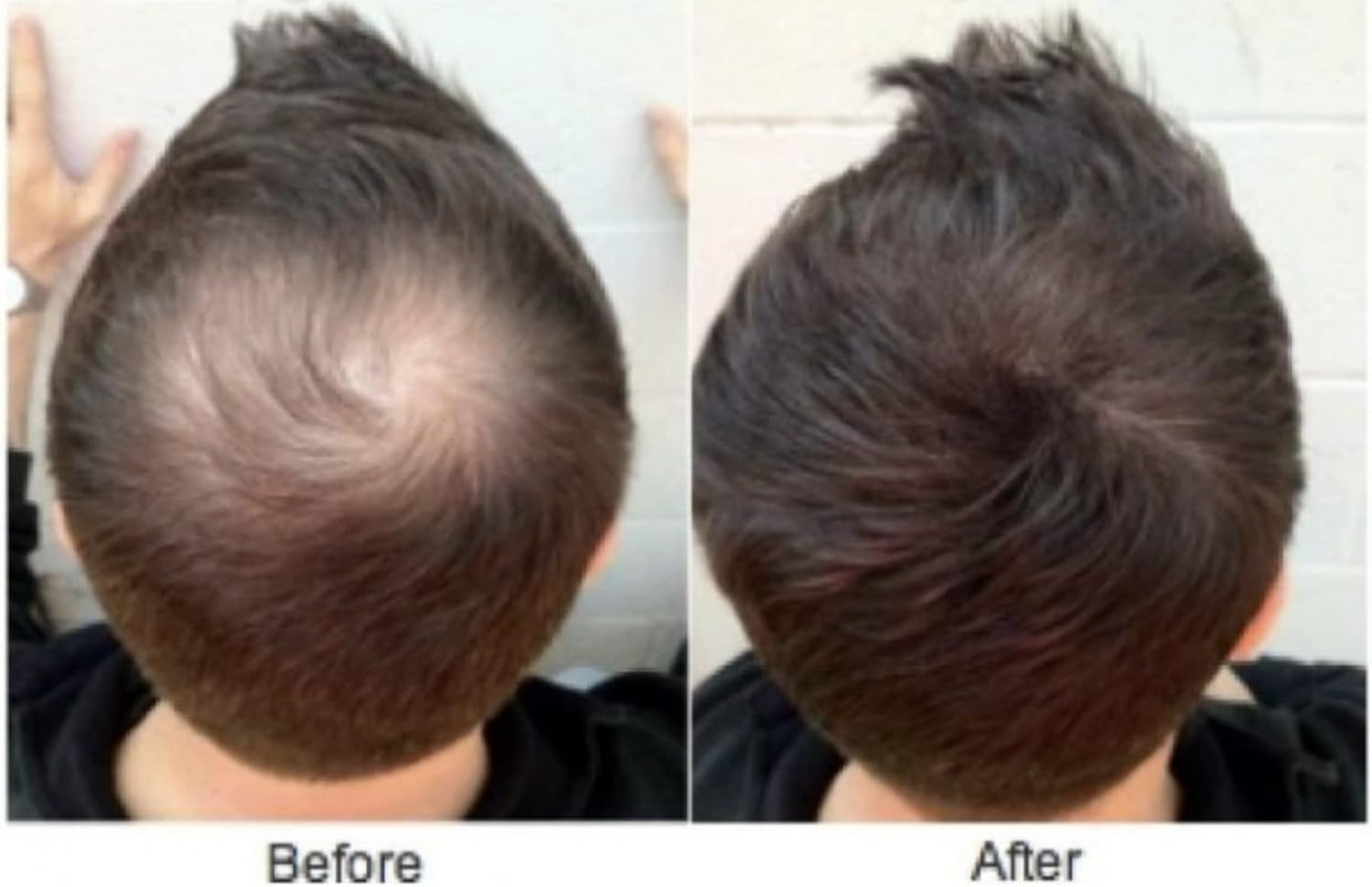 Shills Professional Black Hair Building Fibers Men,Women Fibers for Hair Loss Coverage (Net 25G)