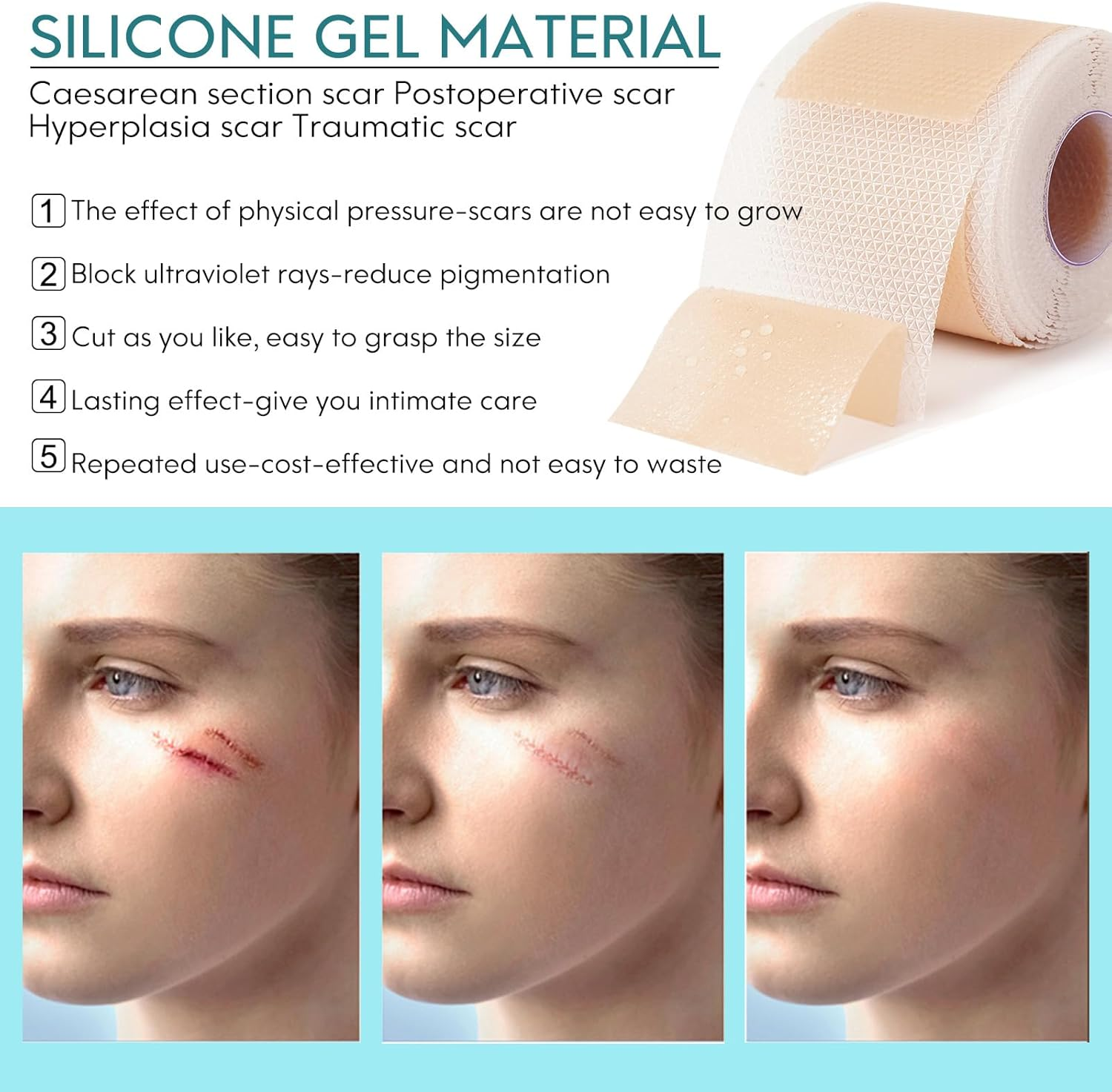 Silicone Scar Tape(1.8" X 157" Roll - 4M), Silicone Scar Sheets, Silicone Scar Tape Roll, Scar Silicone Strips, for C-Section, Surgery, Burn, Keloid, Acne Etc