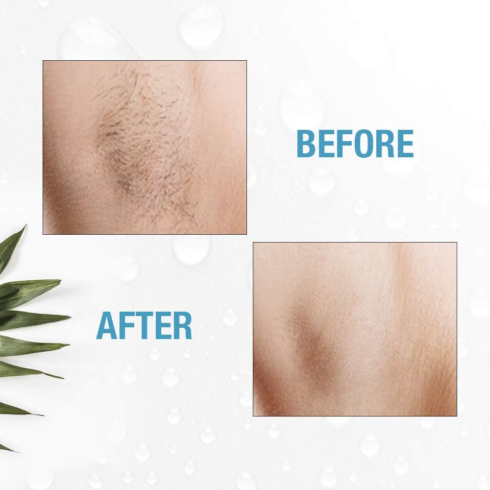 Clean + Easy Electrolysis Machine for Permanent Hair Removal - Non-Laser, Painless Electrolysis Hair Removal for Face & Body, At-Home Remover Device image number 4