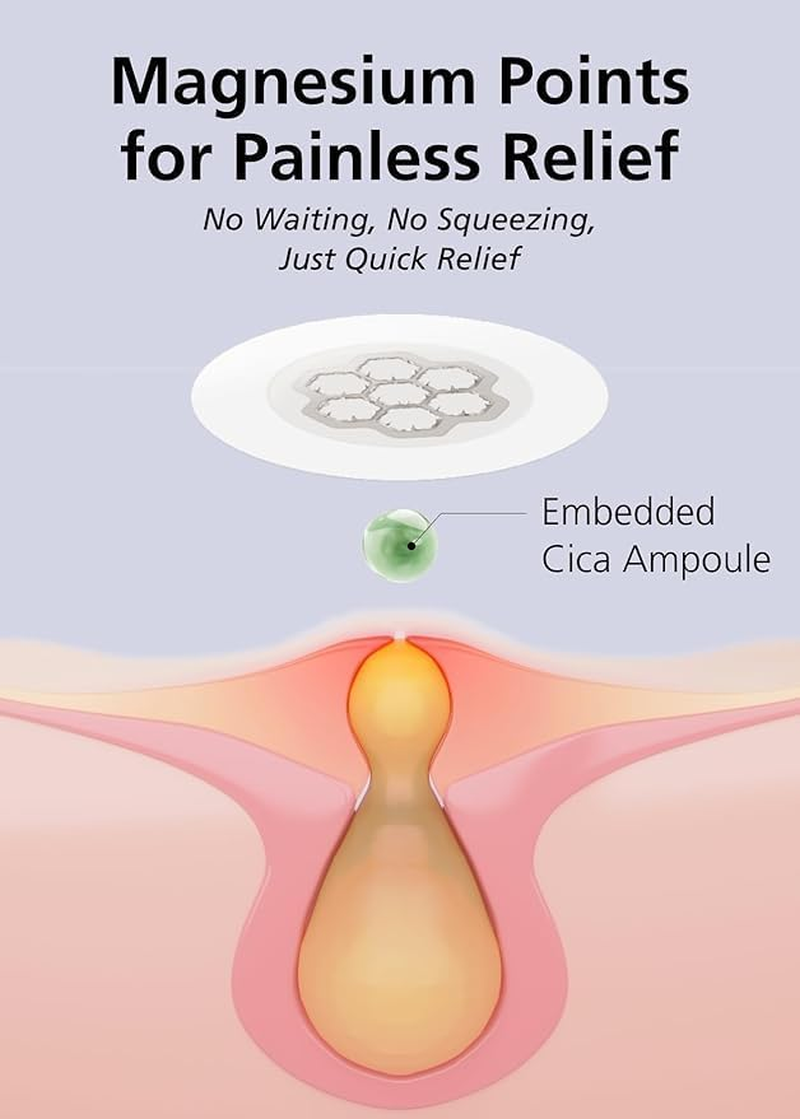 Easyderm Magnesium Pimple Patches &ndash; Hydrocolloid Acne Spot Treatment with Ampoule & Tweezer, 10 Calming Zit Stickers by Daewoong, 이지덤, 대웅제약 image number 3