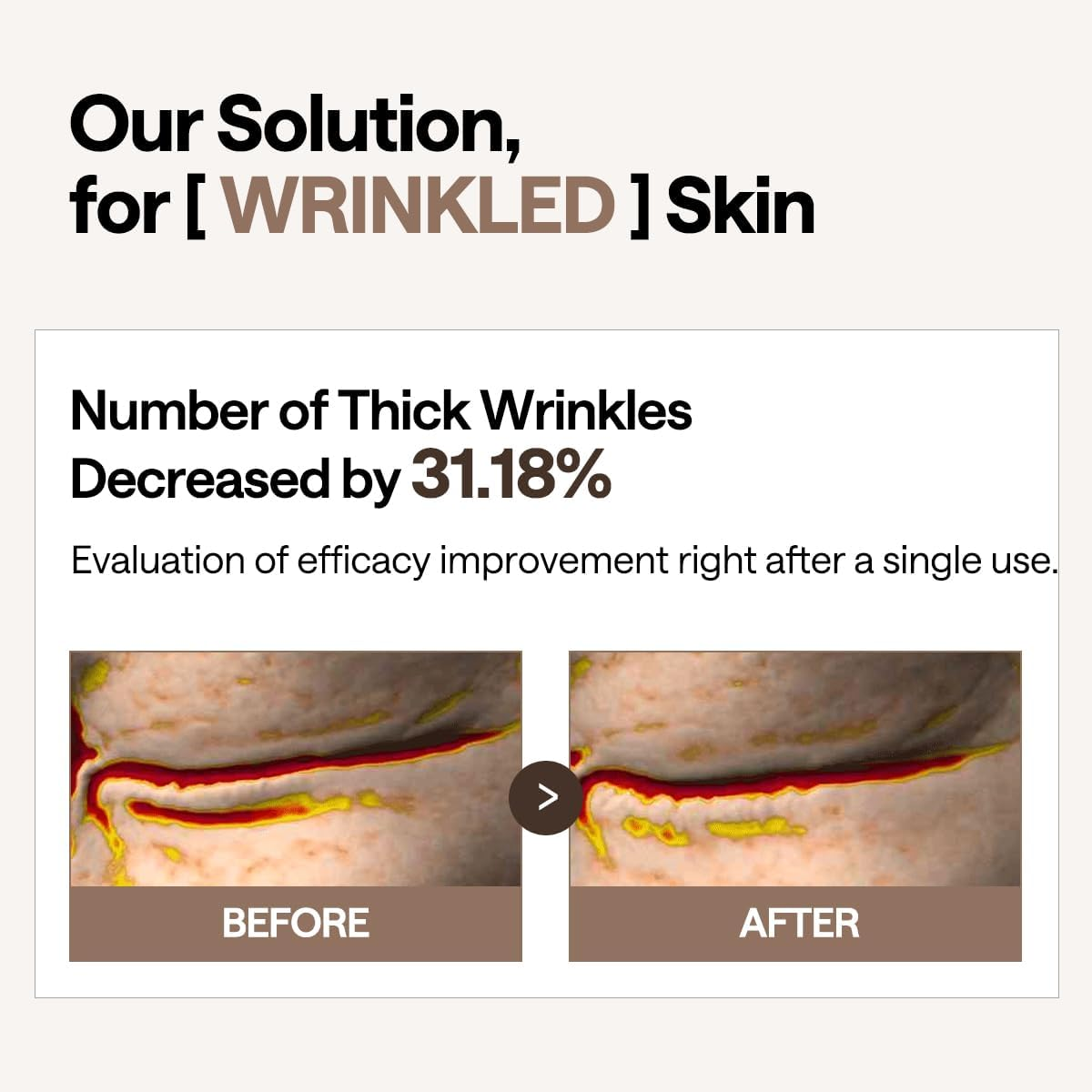 Mediheal Retinol Collagen under Eye Patches - Korean Hydrogel Eye Pads with 95% Retinol & 5 Micro Collagen. Nourishing & Non Irritating Eye Gel Mask. Sealing Cap & Spatula Included.