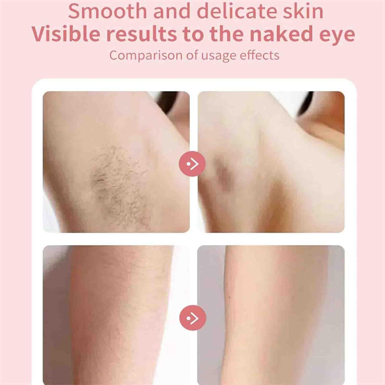 Blissglide Pro&trade; - Silkglide Pro, Silkglide Pro - 2024 Best Silk Glide Razor, Livora Silkglide Pro Razor, Livora Silkglide Pro Shaver, Silky Glide Pro Hair Remover, Silk Glide Epilator (B) - B image number 2