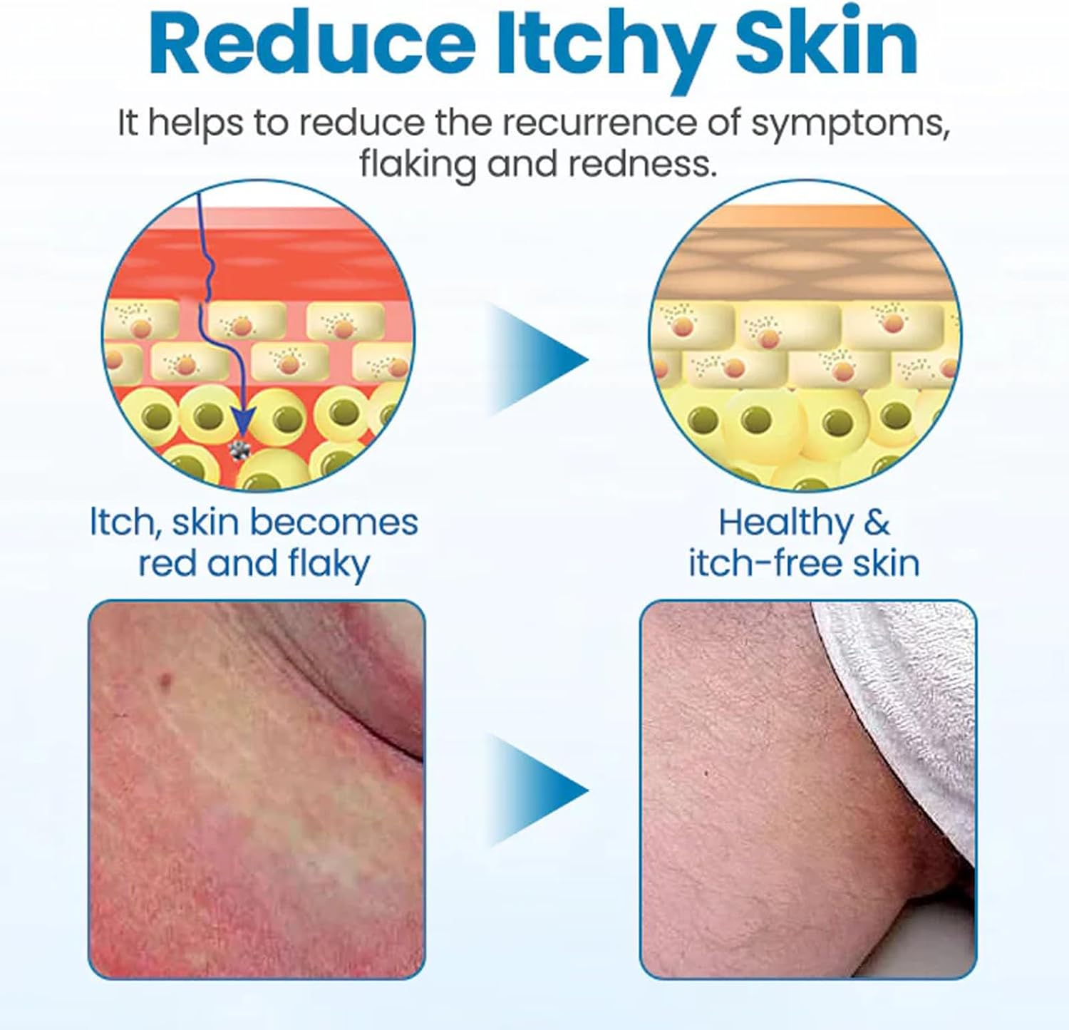 Timilk Men&rsquo;S Gentx Relief Cream, Quickly Relieve Itching Creams, Gentle Moisturizer for Men&rsquo;S Skin Care Routine (2Pcs) - 3Pcs image number 3