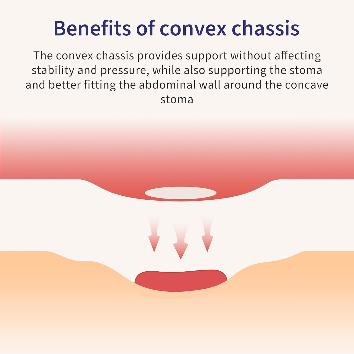 DERAYMI 10 Pack Colostomy Bags Convex with a Belt, One Piece System Ostomy Bag Drainable Pouches Ostomy Supplies Bags for Uneven Wrinkled Skin Irregular Stoma Cut-To-Fit 20-45Mm image number 4