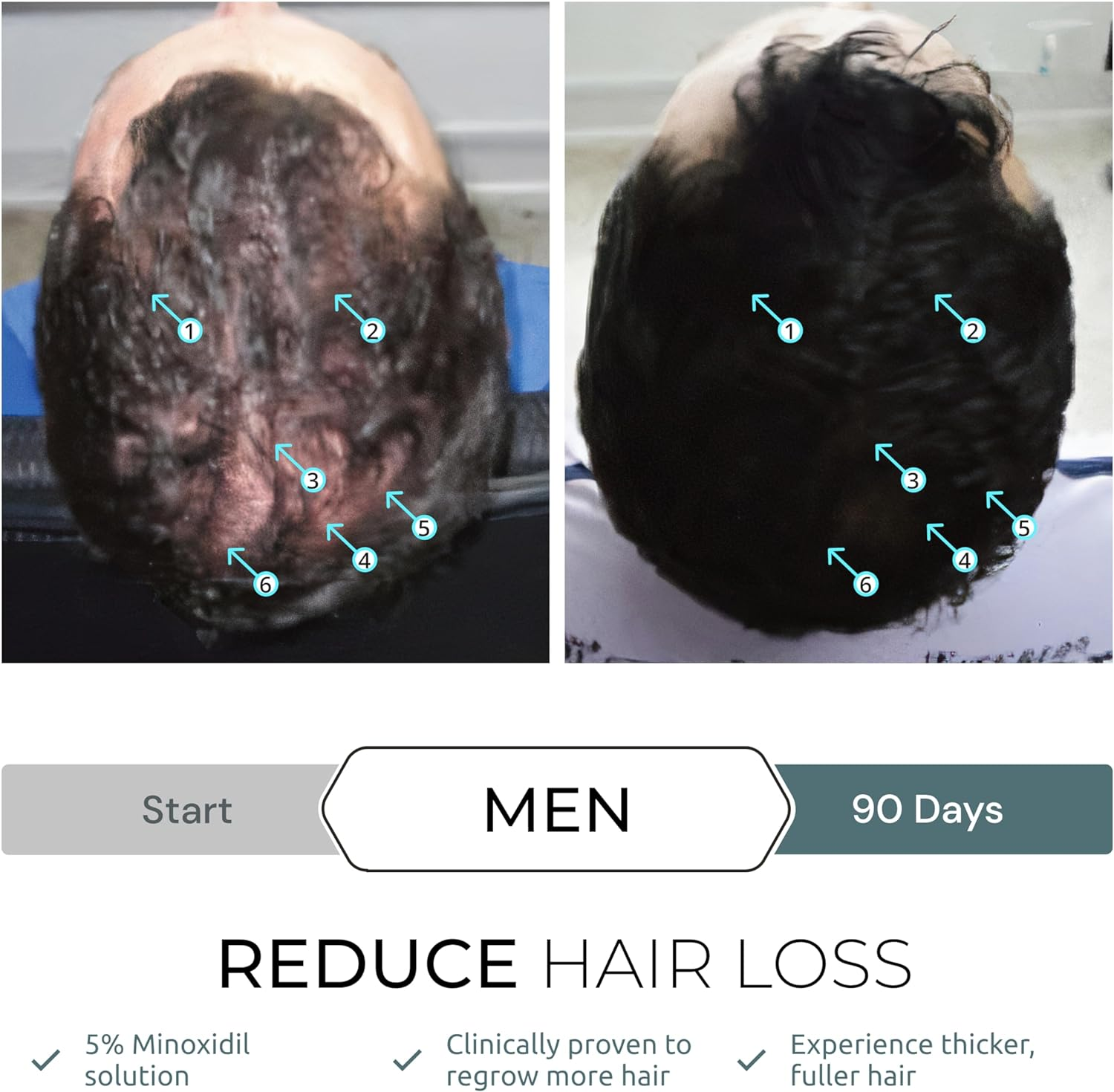 DS Laboratories Spectral.Dnc-N and Spectral.F7 Hair Growth Serum Bundle - Hair Loss and Thinning Hair Treatment, Hair Loss Treatment for Fuller, Thicker Hair for Men and Women (60Ml)