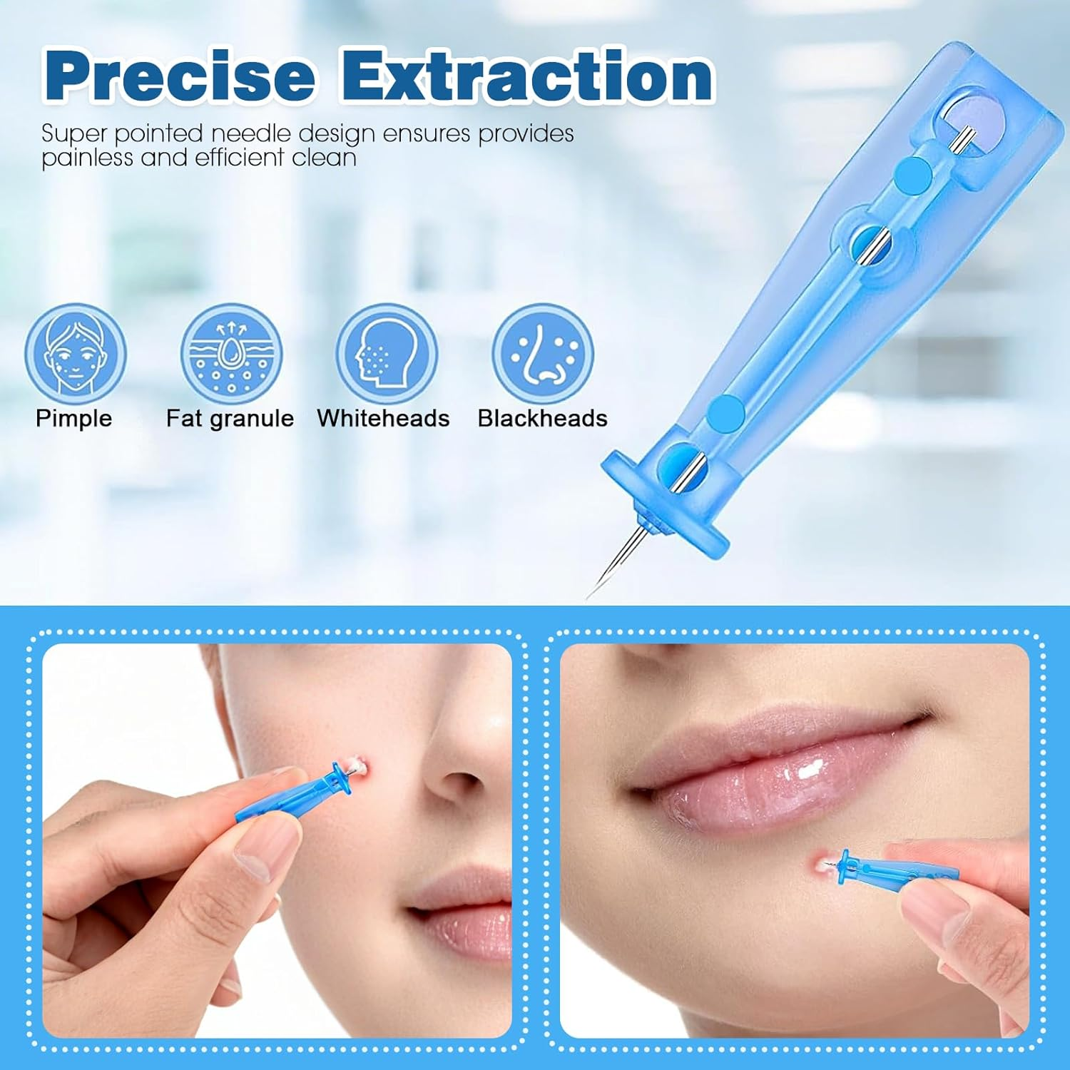 Sterile Acne Needles 100Pcs - 0.01Mm Ultra Fine Needle Tip, Stainless Steel Blackhead Extractor for Painless Acne Removal image number 6